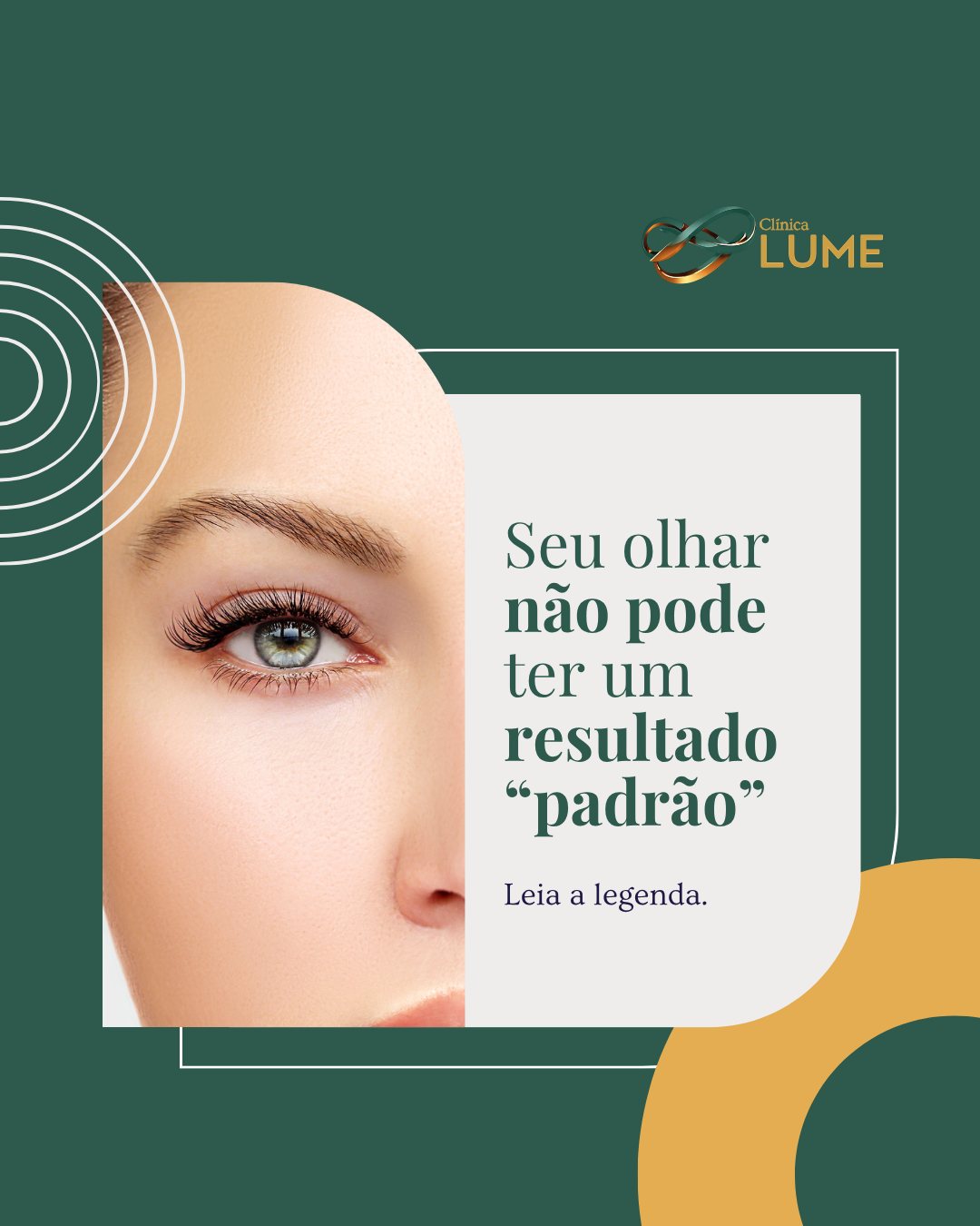 A blefaroplastia moderna vai muito além de retirar pele das pálpebras. Cada cirurgia deve respeitar os traços, a expressão e a identidade de quem você é.
Além disso, blefaroplastia bem planejada busca preservar a função palpebral e evitar consequências como desconfortos e olhos secos. Afinal, abaixo das pálpebras existe um órgão delicado: os olhos.
Na Lume Oftalmologia e Cirurgia, a blefaroplastia é planejada de forma individualizada, analisando sobrancelhas, bolsas de gordura, qualidade da pele e harmonia facial.
Com a Dra. Marília Trindade, cada detalhe é pensado para um resultado sofisticado, natural e personalizado.