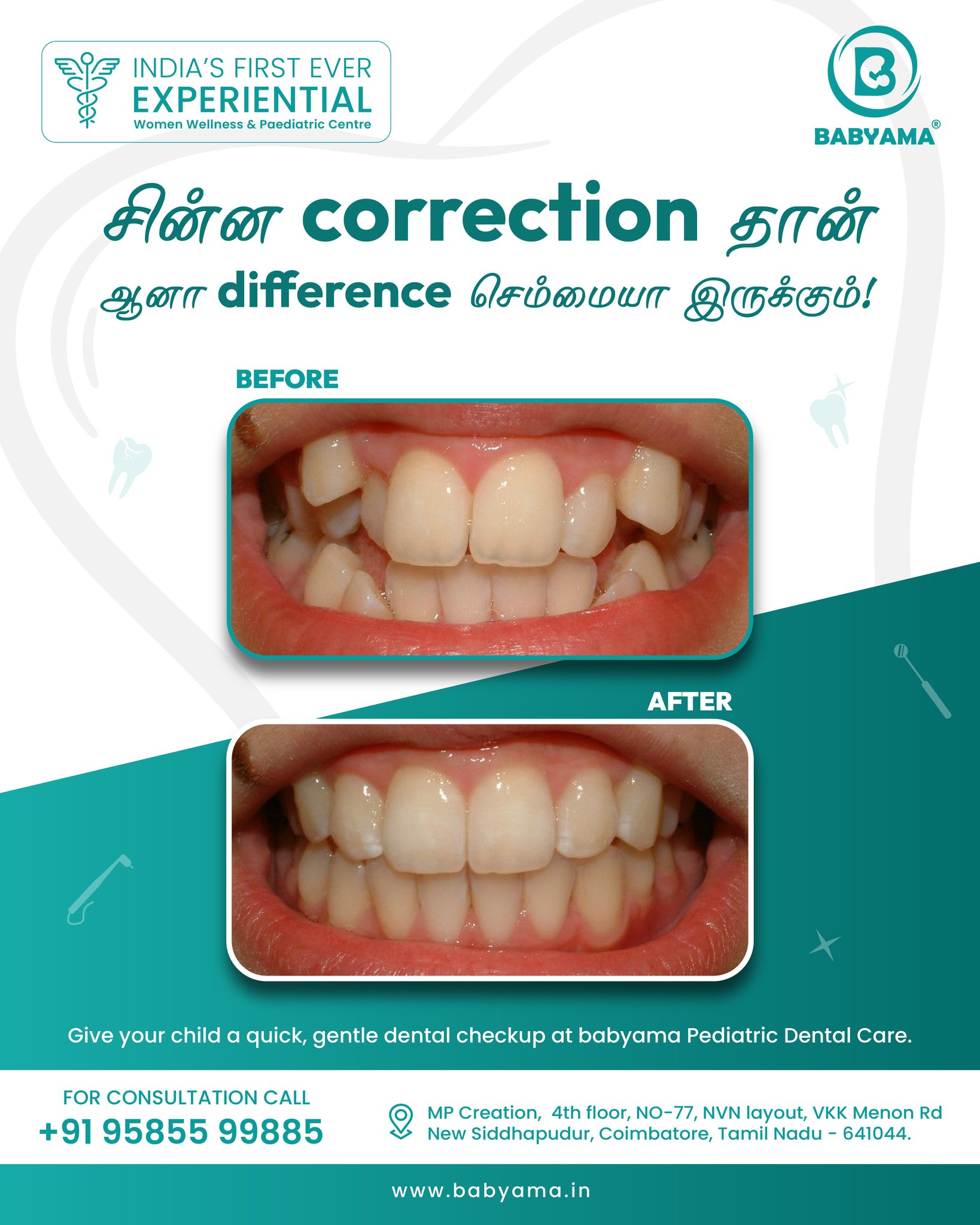A small correction at the right time can make a big difference in your child’s smile.
If teeth are not in the right position, early dental care can help improve both appearance and comfort.
The sooner it is checked, the easier it is to guide in the right way.
At Babyama Paediatric Dental Care, we make sure children feel comfortable and parents feel clear about the next step.
For your Appointment
📞 Book now: +91 95855 99885
📍 Babyama Women Wellness & Paediatric Centre, Coimbatore
#babyama #dental #dentalcare #kidsdentalhealth #coimbatore
