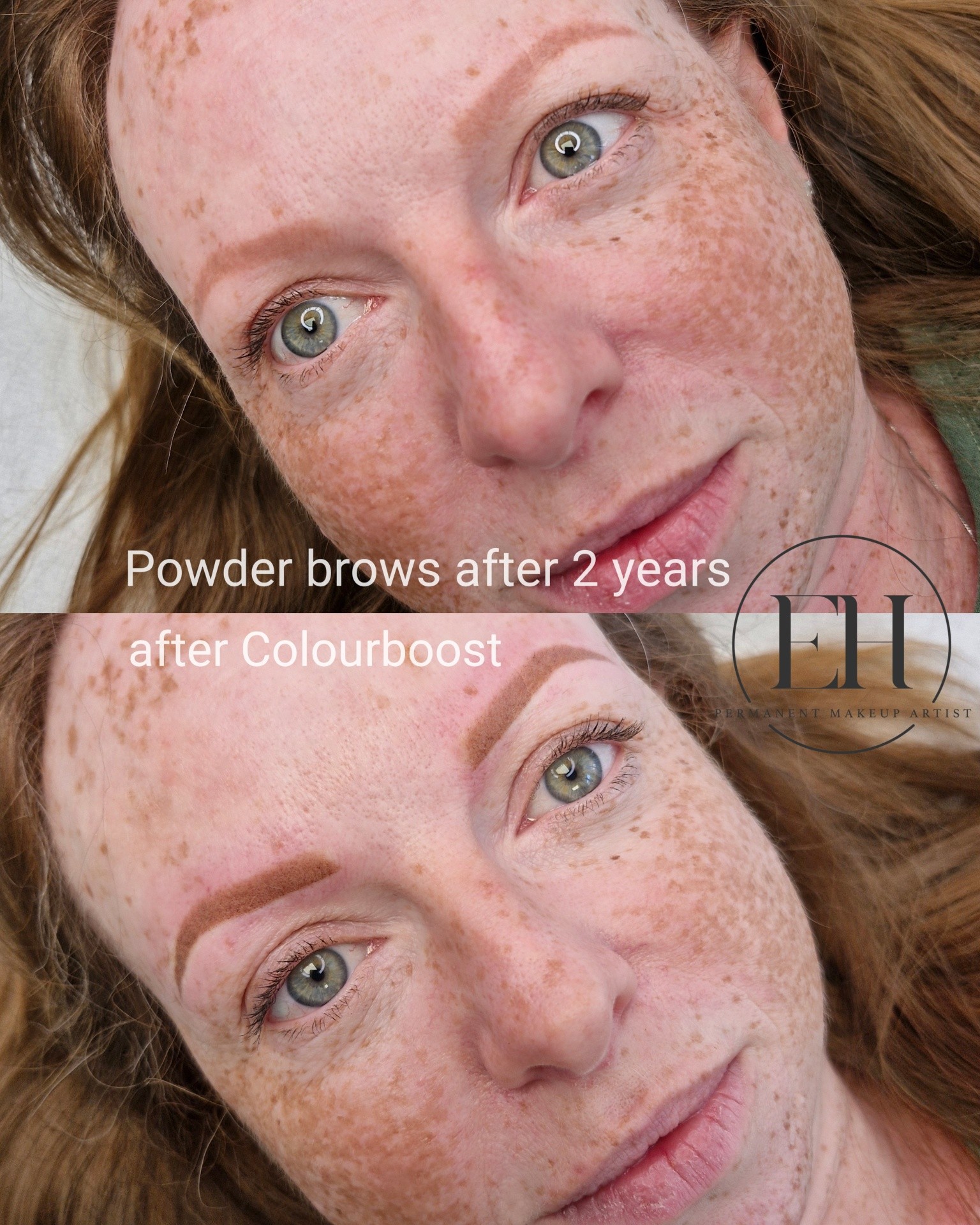 This is exactly what I want to see over the years... soft, natural fading without brows turning grey or blue.
Especially with Kelly's skin tone, cooler grey shades wouldn't be flattering to her complexion. That's why choosing the right pigment is so important.
What many people don't realise is that how your brows age isn't just down to the pigment itself. Understanding skin undertones, pigment behaviour, and implanting pigment at the correct depth all play a huge role in how permanent makeup will look years later.
Sometimes a pigment may even look slightly warmer immediately after treatment, but that's often intentional. As permanent makeup heals and settles into the skin, the colour naturally shifts cooler. My job is to consider not only how your brows look on the day of treatment, but how they'll look months and years down the line.
I spend a lot of time investing in education, studying pigments and refining my technique so I can create brows that heal beautifully and fade softly over time.
My goal is never to create brows that look harsh or overpowering. I want to create brows that complement your features, age gracefully, and still look natural years later.
Permanent makeup isn't just about how it looks today—it's about how it will look in the future.
Do you agree?
#ehpermanentmakeup #naturalbrows #permanentmakeup #powderbrows #stalbans