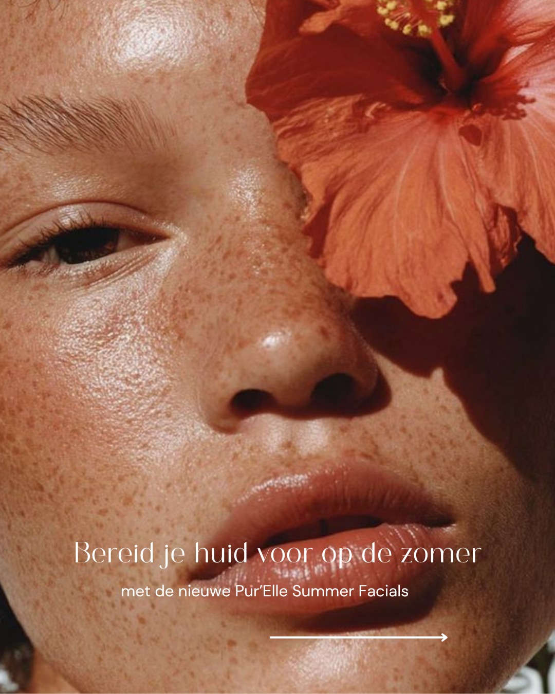 Ring ring… summer is calling ☀️📞
En nee, je huid wordt niet vanzelf “summer ready” 😉
Na de winter en lente voelt je huid vaak doffer, gevoeliger of gewoon… minder fris aan. Daarom is juni het perfecte moment om je huid die extra boost te geven 🤍
Onze gloednieuwe Pur’Elle Summer Facials reinigen je huid diep, verfijnen poriën en geven je die gezonde glow waar iedereen in de zomer naar op zoek is ✨
We werken tegelijk op:
🌿 huidstructuur
🌿 hydratatie
🌿 glow
🌿 én antibacteriële ondersteuning voor een rustige huid
En het leukste? De Summer Facial bestaat in 2 verschillende formules, telkens met een leuk cadeautje erbij 💛
Ontdek alles in deze carrousel en boek je afspraak via www.purelle.be. Heb je al een afspraak gepland en wil je graag één van deze summer behandelingen? Dat kan uiteraard ook!
Your summer skin will thank you 😉
Veel liefs,
Lien
Pur’elle Huidinstituut
☎️ 0494 58 65 50
📩 info@purelle.be
🌍 www.purelle.be