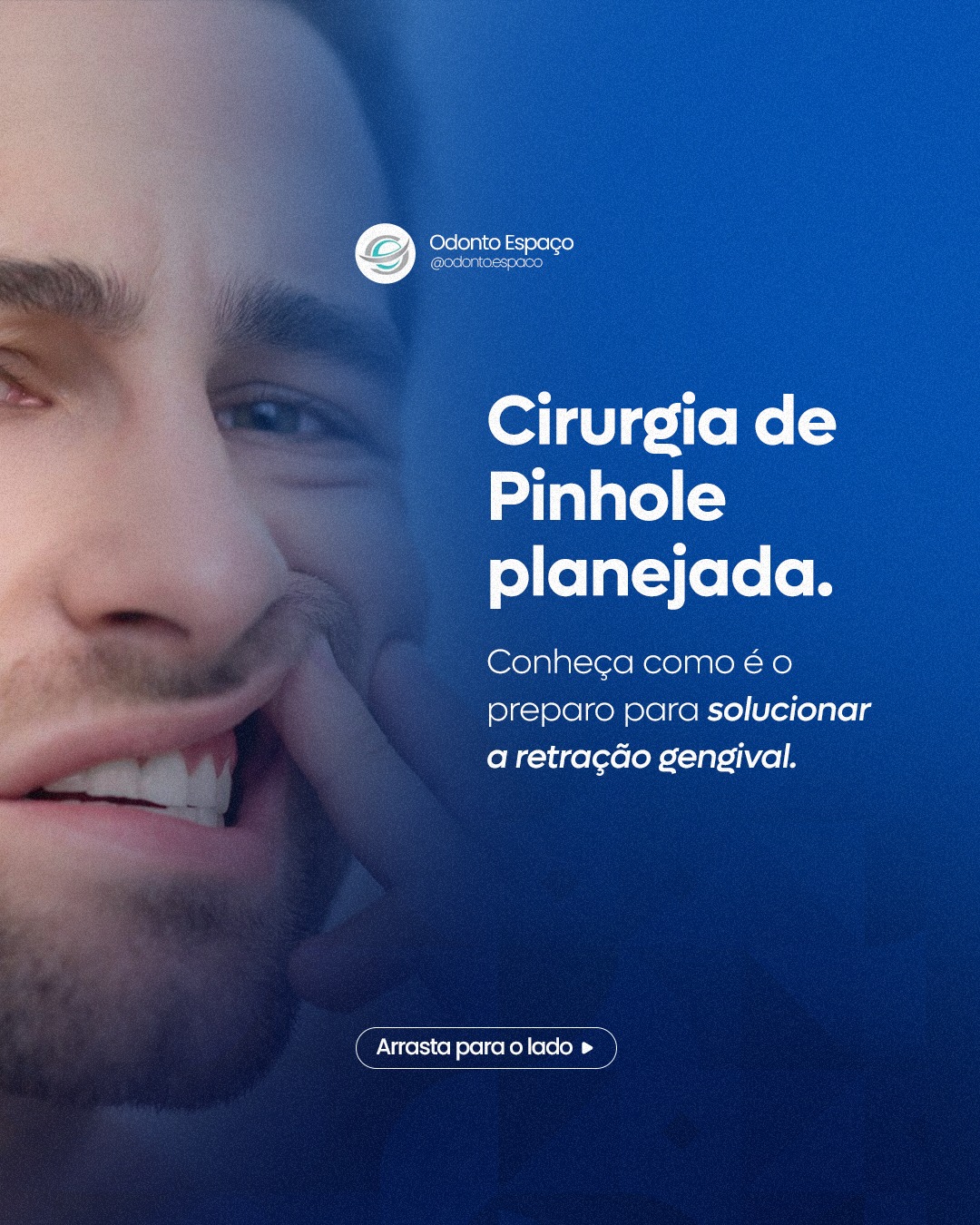 A previsibilidade de uma cirurgia bem-sucedida nasce na precisão do seu preparo. 🔬📐
Para solucionar definitivamente a retração gengival através da Técnica Pinhole, a OdontoEspaço adota um protocolo rígido de credibilidade. Tudo começa na consulta, onde a Dra. Sandra Menendez une a avaliação clínica do relevo gengival e densidade óssea ao Planejamento.
O diferencial? Você participa de tudo. O plano de tratamento é apresentado e discutido com você, garantindo que cada passo respeite a sua biologia individual com margem de erro zero. 🤝🧬
É essa preparação detalhada que traz a segurança e o conforto que o seu sorriso merece. 🛡️✨
👉 Deseja conhecer o plano para o seu sorriso? Clique no link da nossa bio e agende sua avaliação com a Dra. Sandra Menendez. 📩
#CirurgiaPinhole #RetracaoGengival #DraSandra #OdontoEspaco #PlanejamentoReverso #CredibilidadeClinica #VilaMariana #SensibilidadeDentaria #EsteticaDental #OdontologiaDeAltaPerformance #odontoespaço #dentistavilamariana #vilamarianasp #VilaMariana #dentistasp