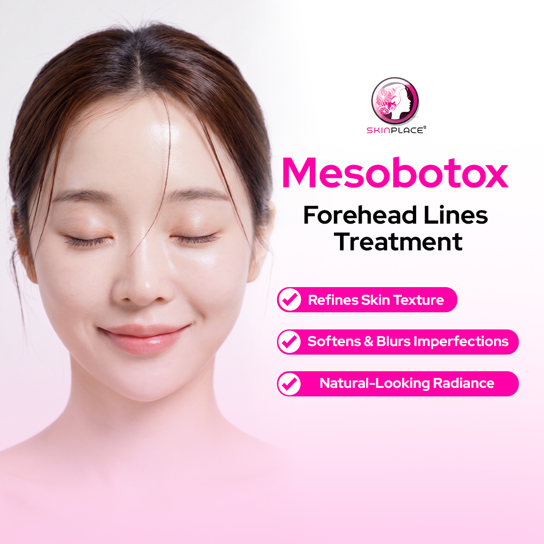 Elevate your skin confidence. ✨
Discover the art of subtle refinement with our Mesobotox Forehead Treatment at Skin Place. Unlike traditional methods, Mesobotox utilizes micro-dosing technology applied superficially to the skin.
The result? It beautifully softens the appearance of fine lines, tightens pores, and creates a smooth, "glass skin" finish—all while maintaining your completely natural facial expressions. 🤍
✨ Why our clients love it:
- Smooths and refines skin texture
- Minimizes the look of surface lines
- Zero harsh downtime
Treat your skin to the premium care it deserves.
📍 Skin Place: Your Skin’s Place.
✨ See comment section for more details! ✨
#SkinPlace #Mesobotox #ForeheadRefinement #GlassSkin #SmoothSkin #AestheticCare #SkinRejuvenation #SelfCare✨