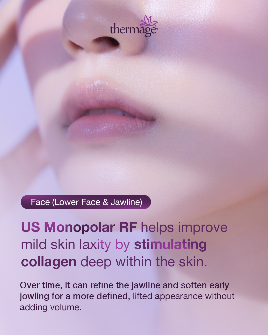 Thermage helps improve mild skin laxity by stimulating deep collagen renewal, gradually refining the jawline, softening early jowling, and improving definition for a more lifted appearance without adding volume.
Results develop gradually as new collagen forms beneath the skin. Over time, this leads to progressive improvements in firmness, elasticity, and overall skin quality for a naturally rejuvenated appearance.
Choose Thermage. Choose The Original Skin Tightening Radiofrequency Device.
THFLX.0034.SG.26
𝘛𝘩𝘦𝘳𝘮𝘢𝘨𝘦®️ 𝘍𝘓𝘟 𝘪𝘴 𝘢 𝘳𝘦𝘨𝘪𝘴𝘵𝘦𝘳𝘦𝘥 𝘮𝘦𝘥𝘪𝘤𝘢𝘭 𝘥𝘦𝘷𝘪𝘤𝘦 𝘪𝘯𝘵𝘦𝘯𝘥𝘦𝘥 𝘧𝘰𝘳 𝘶𝘴𝘦 𝘣𝘺 𝘲𝘶𝘢𝘭𝘪𝘧𝘪𝘦𝘥 𝘩𝘦𝘢𝘭𝘵𝘩𝘤𝘢𝘳𝘦 𝘱𝘳𝘰𝘧𝘦𝘴𝘴𝘪𝘰𝘯𝘢𝘭𝘴 𝘰𝘯𝘭𝘺. 𝘛𝘩𝘪𝘴 𝘮𝘢𝘵𝘦𝘳𝘪𝘢𝘭 𝘪𝘴 𝘧𝘰𝘳 𝘪𝘯𝘧𝘰𝘳𝘮𝘢𝘵𝘪𝘰𝘯𝘢𝘭 𝘱𝘶𝘳𝘱𝘰𝘴𝘦𝘴 𝘢𝘯𝘥 𝘥𝘰𝘦𝘴 𝘯𝘰𝘵 𝘤𝘰𝘯𝘴𝘵𝘪𝘵𝘶𝘵𝘦 𝘮𝘦𝘥𝘪𝘤𝘢𝘭 𝘢𝘥𝘷𝘪𝘤𝘦. 𝘗𝘭𝘦𝘢𝘴𝘦 𝘤𝘰𝘯𝘴𝘶𝘭𝘵 𝘢 𝘭𝘪𝘤𝘦𝘯𝘴𝘦𝘥 𝘩𝘦𝘢𝘭𝘵𝘩𝘤𝘢𝘳𝘦 𝘱𝘳𝘰𝘧𝘦𝘴𝘴𝘪𝘰𝘯𝘢𝘭 𝘧𝘰𝘳 𝘱𝘦𝘳𝘴𝘰𝘯𝘢𝘭𝘪𝘴𝘦𝘥 𝘵𝘳𝘦𝘢𝘵𝘮𝘦𝘯𝘵 𝘨𝘶𝘪𝘥𝘢𝘯𝘤𝘦.
#ThermageFLX #TheOriginalRadiofrequency #SkinTightening #ThermageEyes #5Millionandcounting
