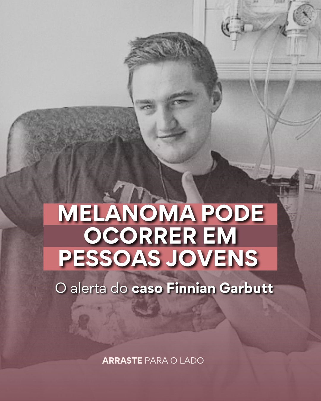 O câncer de pele não tem o rosto que você imagina.
Muitas vezes, a imagem que temos do melanoma é de alguém com pele muito clara e idade avançada. O caso de Finnian Garbutt, diagnosticado ainda jovem, vem para quebrar esse mito e nos dar um alerta urgente.🚨
O melanoma é silencioso, mas a pele sempre fala através de sinais e por isso prevenção é crucial.
Você já fez seu check-up de pele este ano? Não deixe para depois.
Dra. Júlia Lóss - Médica Dermatologista Oncológica
CRM 5201085638 RQE 34041
#finniangarbutt #cancerdepele #melanoma #dermatoscopia #mapeamentocorporaltotal