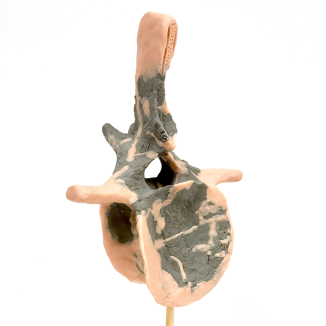 Yesterday I had arts and crafts time at work, and it was SO much fun! As part of a collaboration with Dr. Matt Wedel I am helping to reconstruct vertebrae from Haplocanthosaurus, and type of sauropod dinosaur.
.
First, we CT scanned a series of #caudal (tail) vertebrae. Next, we worked with our 3D visualization department, who made a 3D print of our best vert at 85% actual size. THEN Matt and I sculpted on the missing and broken parts (this was the really fun part!). .
Here you see the 3D print in grey, and our sculpted portions in baby pink. Now it will be scanned again, and our colleagues will digitally remove deformations. Ultimately we want to reconstruct the vertebrae both digitally and in 3D prints to help is understand the spinal cord anatomy of these animals. Technology is super cool!! .
Swipe for a pic of the sculpting process in action, and check out SVPOW for Matt’s blog post about the project!
.
#science #scienceteacher #scienceart #technology #3dprinting #sauropod #haplocanthosaurus #vertebrae #dinosaur #scicomm #paleontology #ladyscientist #womeninstem