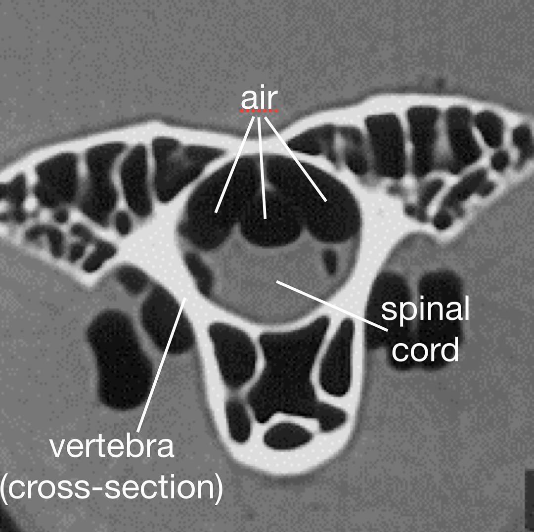 Hi, everyone! This is going to be the second in a series of posts about weird air-filled structures in birds. 😄
.
Anyone who has talked science with me lately knows I’ve been having a research-obsession with something called supramedullary airways (yeah, it’s a mouthful!). My friend Matt Wedel got me hooked on this very niche but very interesting aspect of bird anatomy. Check out his blog for more info about our recent research: svpow.com!
.
Birds need lots of oxygen to fly, but their lungs are actually super small. BUT, they are connected to an elaborate system of air sacs, basically balloons of all shapes and sizes found throughout the body—under the skin, between muscles, in body cavities, and INSIDE of bone.
.
Sometimes branches of these air sacs go inside of the vertebral canal and contact the spinal cord! These are called supramedullary airways.
.
They come in all shapes and sizes in different birds. In my last post you saw them in a pelican. This is what they look like in an ostrich. (Colors in second pic: yellow - bony vertebral canal, magenta - spinal cord, teal - supramedullary airways.)
.
Some birds have them, some don’t. Sometimes they are big, sometimes they are tiny. Right now we’re documenting the variation seen in many types of birds and are super excited by all the weird differences! You can see in the ostrich the airways are present as three tubes on top of the spinal cord. They don’t fully encase it like in the pelican. More to come soon!
.
#bird #ostrich #ctscan #comparativeanatomy #birdanatomy #science #scicomm #livingdinosaur #womeninstem #niche #anatomy