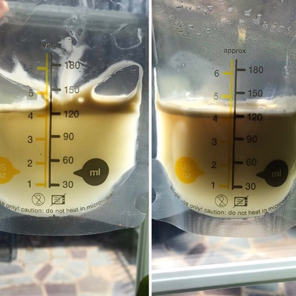 While I generally do not find it helpful to focus on the concepts of “foremilk” and “hindmilk”, I do love how different milk can look. The photo on the left was caught in a Hakaa during a let-down and the one on the right was pumped milk after breastfeeding. Look at how much creamier it is. It’s so cool how variable your milk is. #humanmilk #breastmilk #breastmilkbaby #breastfeeding #breastfeedingmom #forresterlactation