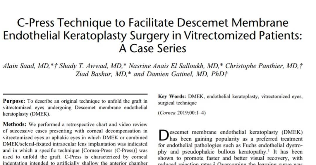 New technique for Dmek in complex eyes. #eyesurgery #cornea #cornealtransplant #keratoplasty #dmek #dsaek #aubmc #fondationrothschild