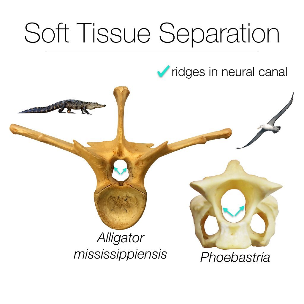 Part 4 of Atterholt and Wedel, SVPCA 2019: a quest to understand neural canal ridges in the tails of sauropod dinosaurs.
.
After a couple ideas that didn’t pan out, we took a closer look at bony ridges that separate the spinal cord from other soft tissues in modern birds and crocodylians. This seemed promising, because they are bony ridges actually in the canal and located on the sides of the wall. So far, so good!
.
In crocs and alligators this bony ridge separates the spinal cord from a large dorsal spinal vein. In bird, it separates the spinal cord from paramedullary airways, a fancy term for parts of the respiratory system that contact the spinal cord and sometimes enter the vertebral canal! I know, it’s really weird.
.
However...this idea, too, didn’t pan out. These ridges in crocs and birds extend aaallll the way to the ends of the vertebral canals (since the soft tissues they separate pass through multiple vertebrae, this makes sense). As a result, they change the shape of the canals. Can you see how they are 8-shaped? This is also NOT what we were seeing in the tail vertebrae of sauropods.
.
#science #anatomy #comparativeanatomy #vertebrae #dinosaur #sauropod #svpca2019 @mathew.wedel