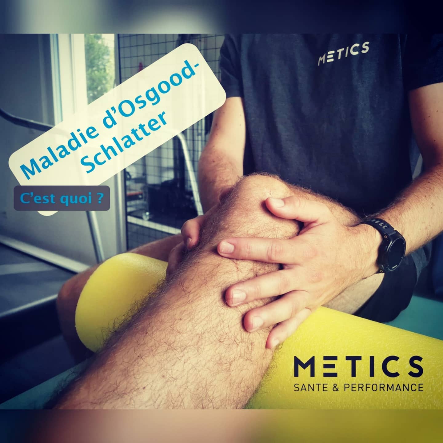 🤗 C’est une maladie qui touche les adolescents entre 10 et 15 ans !
Cette maladie de croissance 📈 survient à cause de la traction répétée du tendon rotulien🦵 sur la tubérosité tibiale.
Elle touche environ 20% des enfants sportifs ⛹️♀️, et la plupart du temps, les deux genoux sont douloureux 😭
📋 Symptômes: douleur située au niveau antérieur du genou, sensibilité à la palpation, œdème au niveau de la tubérosité.
💡 Traitement: Evaluation posturale, thérapie manuelle, exercices de renforcement et de mobilité individualisés. --> metics.agenda.ch
🤕 Une diminution du volume d'entraînement ou un repos s'avèrent importants.
#meticssanteperformance #justforyou #physiothérapie #interdisciplinaire