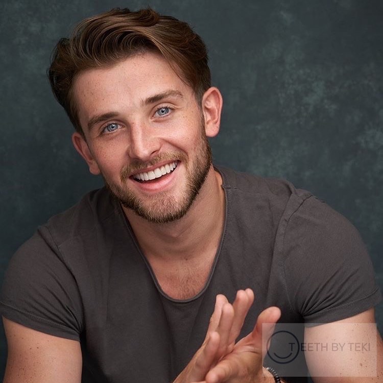 Composite bonding that’s suits your face
.
.
@mrbenjamindarcy what a smile
.
.
#compositebonding #teethbyteki #yourstyleyoursmile