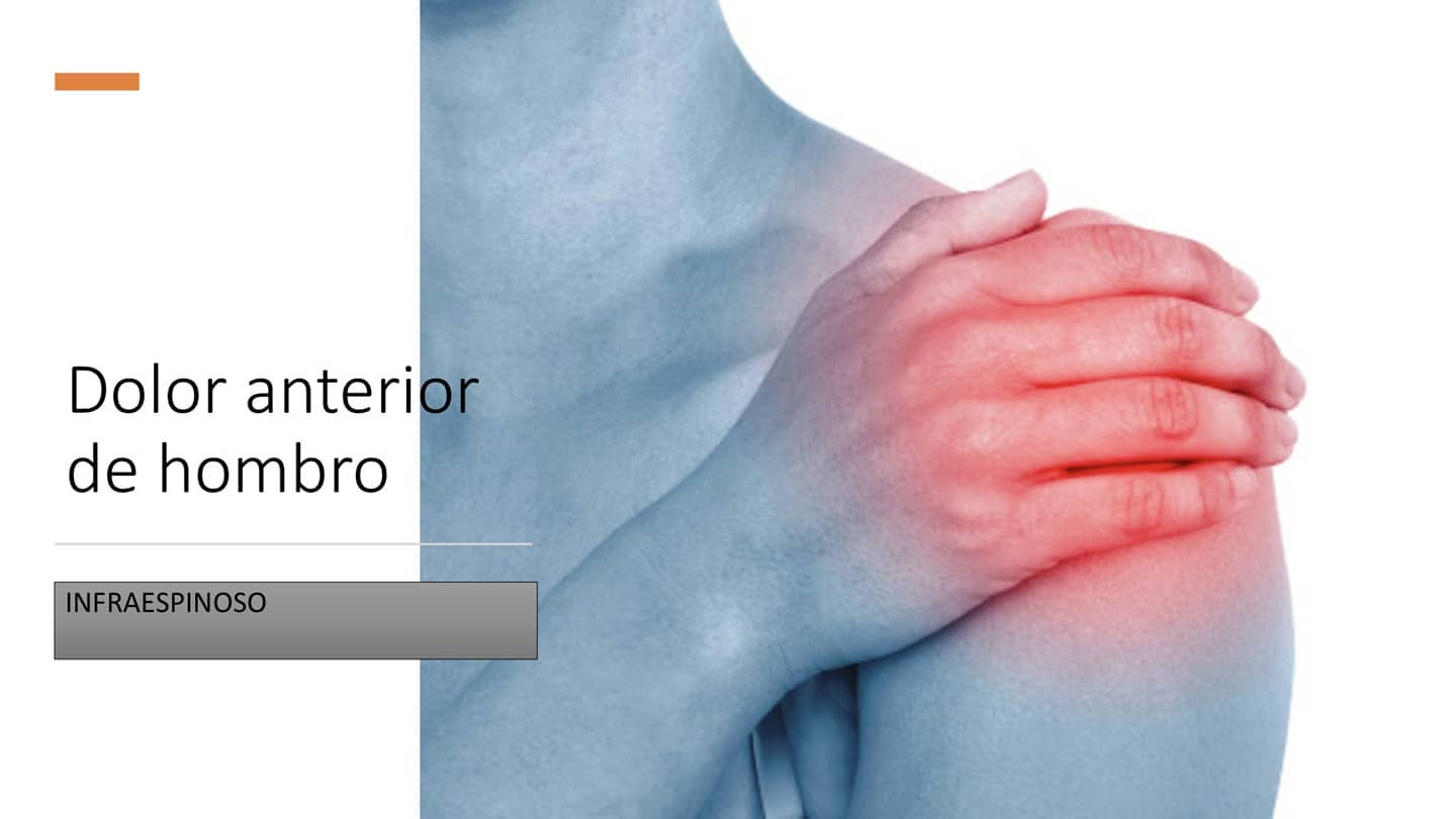 Hoy os traigo la segunda parte relacionada con el dolor del hombro. En el post anterior os hablé sobre el supraespinoso y hoy os traigo un poco de información sobre su "primo" el infraespinoso.
📝 Normalmente el dolor anterior de hombro cursa en mayor o menor grado con afectación de estos dos músculos, ya que actúan de forma sinergica en un complejo super importante del hombro, el famoso "manguito rotador".
✅ En este caso el infraespinoso principalmente intervendrá en acciones que requieran que rotemos el hombro externamente (tipo lanzamiento de handball).
✅ Sin duda alguna, es indispensable tratar los dos a la par, ya que si no no conseguiremos una buena mejora del paciente en la mayoría de los casos.
Si sufres de dolor de hombro y quieres preguntarme alguna inquietud acerca de tu caso no dudes en hacerlo, sin duda te intentaré ayudar encantado🏋️♂️.
#fisioterapia #dolor #hombros #infraespinoso #manguitorotador #rehabilitación #supraespinoso #ejercicio #fuerza #tendinopatia #traumatologia #recuperacion