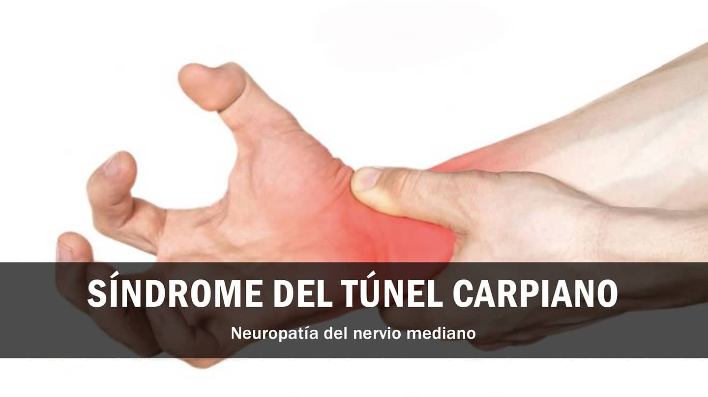 Hoy hablaremos acerca de una de las patologías más frecuentes de la mano y muñeca, el síndrome del túnel carpiano.
📝La estructura conocida como "túnel carpiano" esta compuesta por un ligamento a nivel de la muñeca que delimita a un conjunto de tendones de músculos flexores, estructuras vasculares y al famoso NERVIO MEDIANO.
Cuándo dicho nervio queda comprimido dentro de esta estructura es cuando aparecen los síntomas asociados a esta patología, que principalmente son:
⛔Dolor en mano y muñeca
⛔Perdida de fuerza de la mano
⛔Inchazón de muñeca y mano
⛔Hormigueo y adormecimiento recurrente (sobretodo por noche)
Gran porcentaje de las personas que sufren de esta patología acaban en quirófano y pese a eso, muchas siguen presentando síntomas igualmente, a veces en menor grado‼️
Cuándo esto sucede es debido a que la COMPRESIÓN DEL NERVIO MEDIANO NO ES EXCLUSIVAMENTE A NIVEL DE MUÑECA.
Este nervio puede quedar atrapado también a NIVEL CERVICAL o incluso en el CODO.
🧑⚕️ Si sufres de esta patología te recomiendo visitar a un fisioterapeuta que sepa tratar este tipo de casos y que te AYUDE, antes de ir directamente a quirófano.
Si este es tu caso y quieres hacerme alguna consulta al respecto, no dudes en hacerlo.
#fisioterapia #dolor #nervio #tunelcarpiano #fuerza #incapacidad #mano #muñeca #rehabilitación #recuperacion #readaptacion #analgesia #dosrius #canyamars #canmassuet #cardedeu #llinarsdelvalles #mataro #granollers
