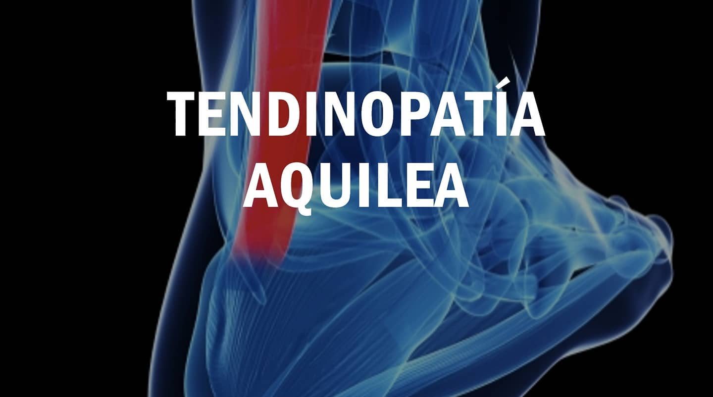 ¿No te ha dolido nunca la parte de atrás del talón? 🤔
📝 Seguramente si has empezado a hacer deporte o si ya llevas tiempo pero cada vez tu nivel de exigencia es mayor, habrás notado un dolor muy localizado detrás del talón.
Es un dolor raro, que aparece sobretodo al hacer cierta actividad, que es muy localizado y que disminuye al llevar un rato haciendo ejercicio, pero al acabar vuelve con más intensidad.
Si te encuentras en esta situación, podría ser que sufras de algo conocido como tendinopatía del tendón de Aquiles.
Si este es tu caso, te animo a que veas el post e incluso me preguntes más sobre tus dudas.
Lo principal a hacer:
✅ Gestionar la carga del ejercicio
✅ Elaborar un plan de reintroducción
Pero sobretodo:
⛔ NO PARAR A ESPERAR QUE EL DOLOR DESAPAREZCA POR SI SOLO
El motivo es muy simple, el tendón tiene una particularidad muy especial:
SE ADAPTA Y DESADAPTA A LA CARGA CON MUCHA FACILIDAD‼️ Esperar a que se pase por si solo te llevará un tiempo, pero lo peor, es que lo convertirá en un tendón más débil y llorón. Por lo que cada vez se quejará más por actividades más sencillas.
#clinica #fisioterapia #fisioterapeuta #fisio #ortopedia #osteopatia #neurologia #fisioterapiaesportiva #terapiamanual #ejercicio #carga #readaptacion #tendinopatia #aquiles #fisiologia #rehabilitación #fisioterapiadeportiva #dosrius #argentona #mataro #granollers