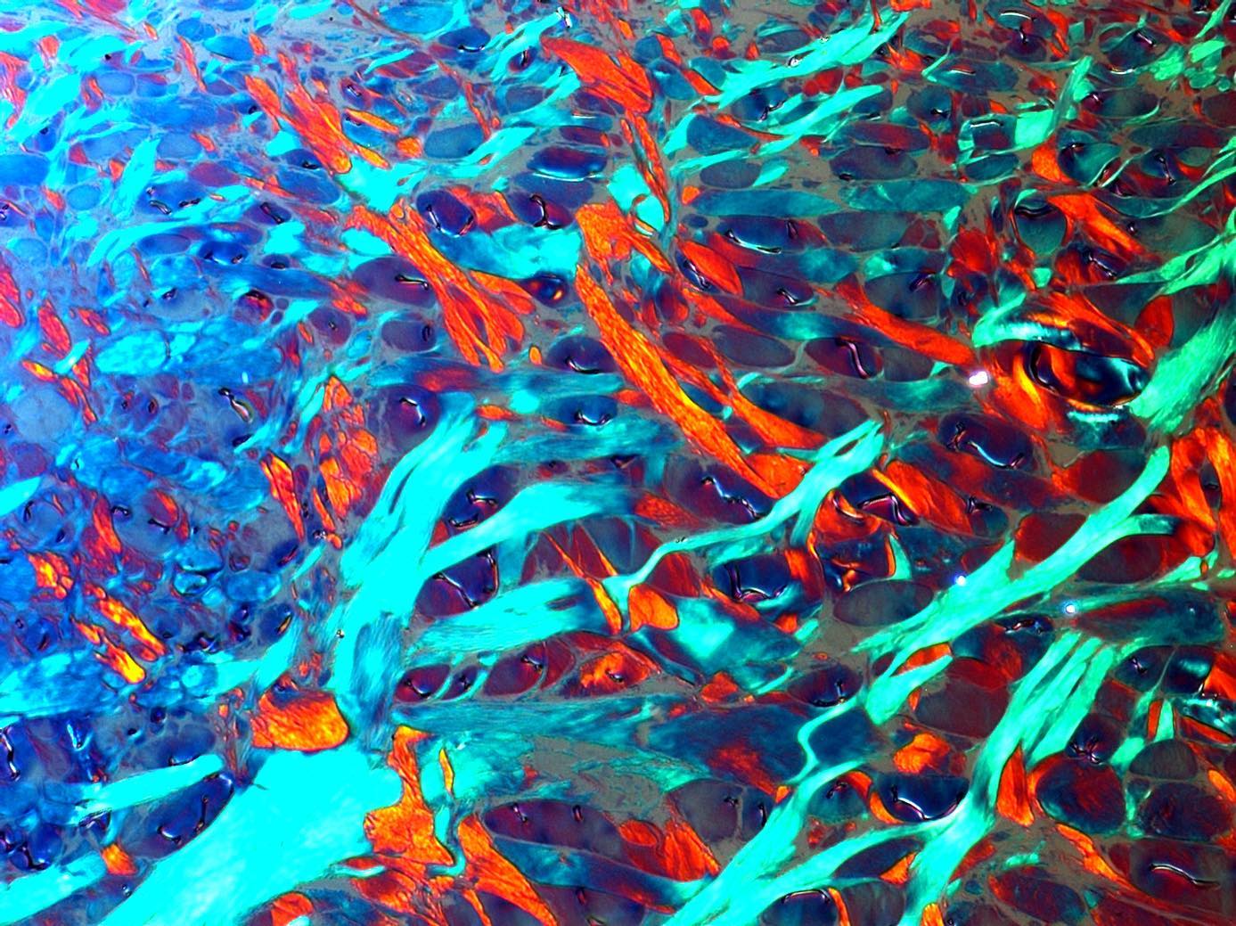 Lizard collagen fibres
#science #electronmicroscope #laboratory #scienceart #sciencephoto #scientific #scienceweek #research #lab #micro #microscope #microscopy #medicine #medicalsciencestudent #medicalstudent #macrophotography #mineralomics #bio #biology #bioimaging #biologylab #minerals #chemistry #material #engineering #physics #sciencecommunication #ucl #Mineralomics