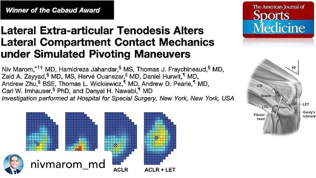 New Publication! Awesome Team’s Work 👊 #aclsurgery #sportsmedicine #hss #santigroup