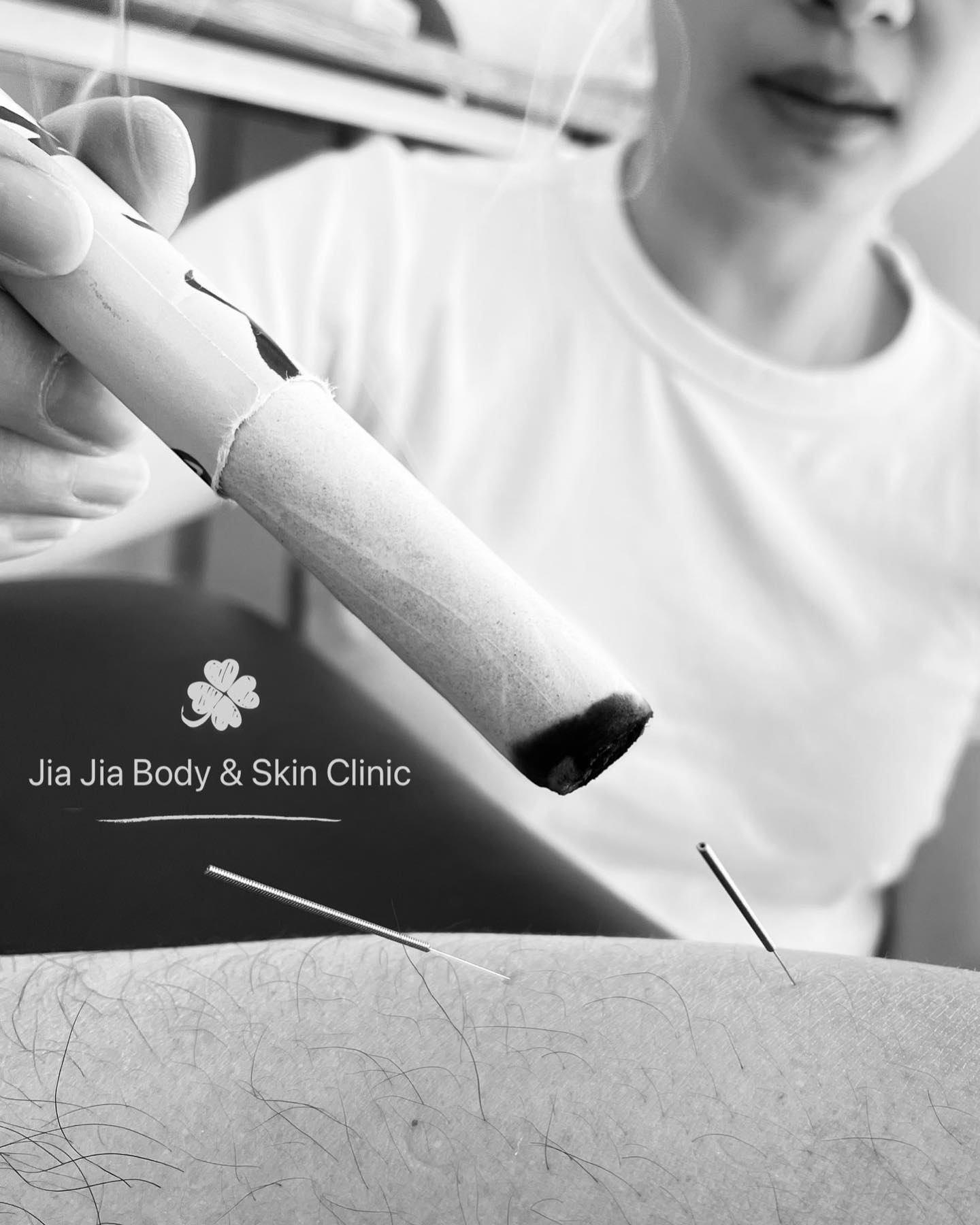 Modern research has demonstrated acupuncture's effects on the nervous system, endocrine and immune systems, cardiovascular system, and digestive system. By stimulating the body's various systems, acupuncture can help to resolve pain, and improve sleep, digestive function, and sense of well-being.
#acupunture #针灸
#moxa #chinesemedicine #painmanagement