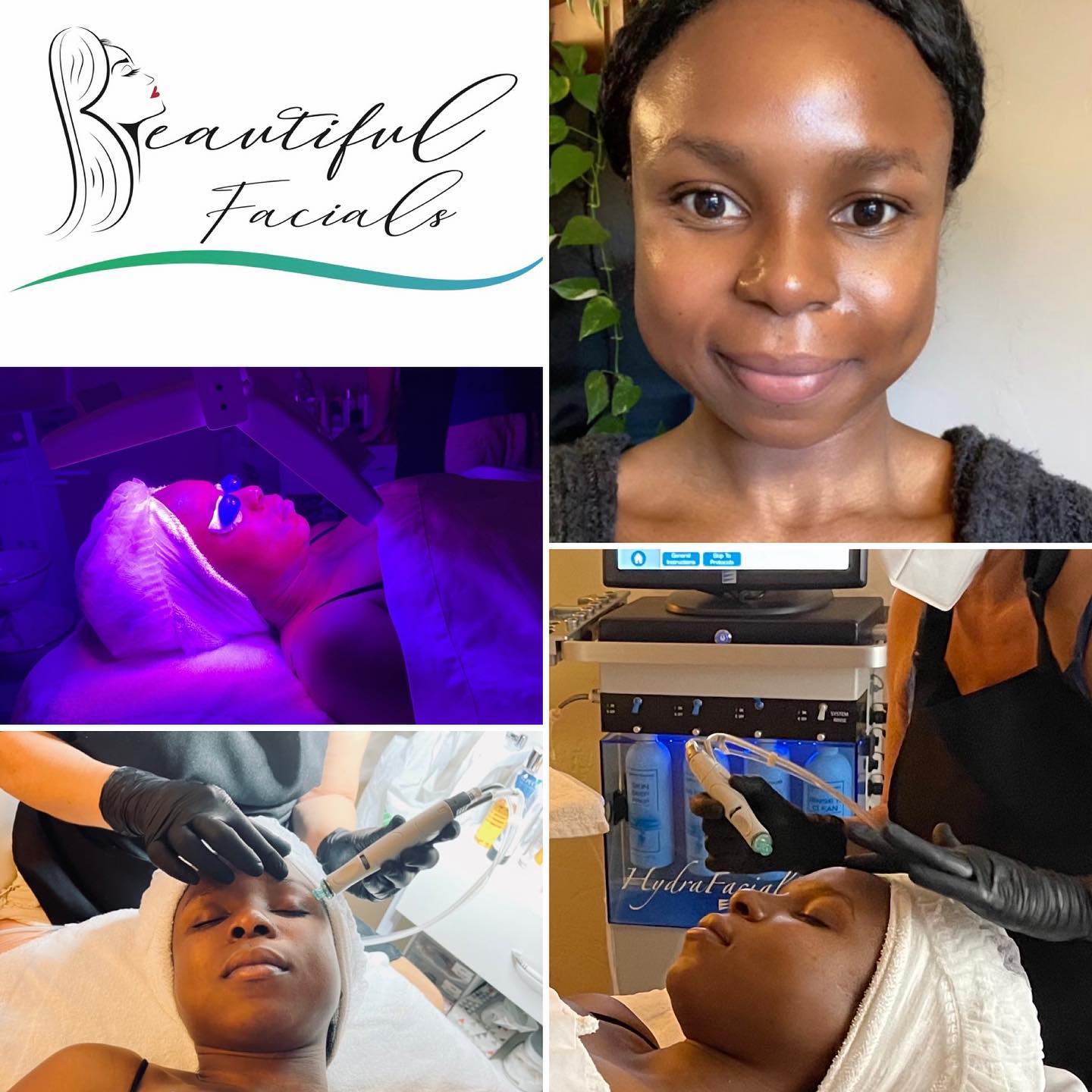 🦋🦋🦋🦋 #beautifulfacials #lightstim #esthetician #hydrafacial #deepporecleansing #sanmarcos #carlsbad