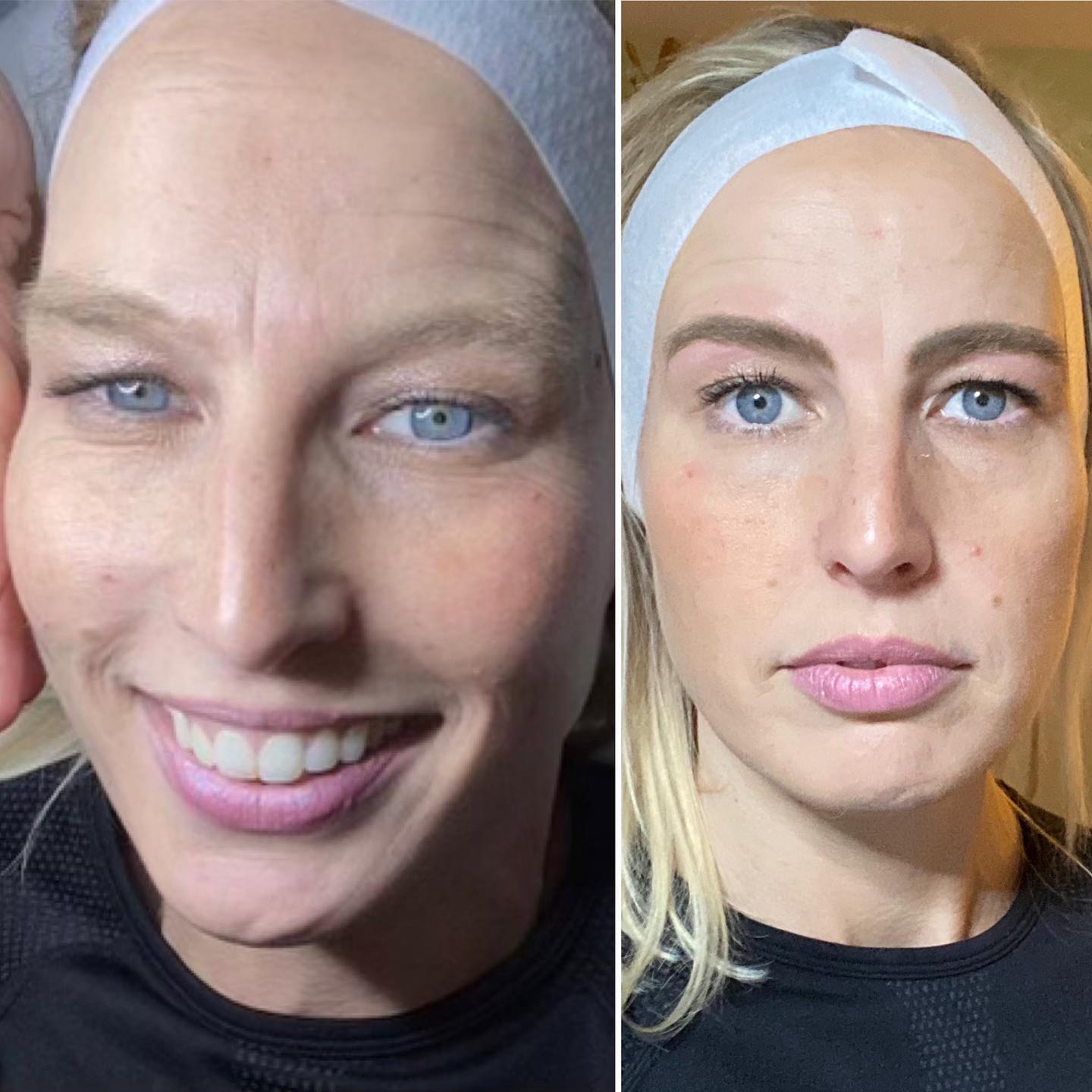 Beautiful brows @
Beautiful Facials
Follow my business page!
Link in Bio
#brows #tinting #facialwaxing #waxing #beauty #beautifulbrows
#dermaplane
#Beautifulfacials #hydrafacial #facials #ledlighttherapy