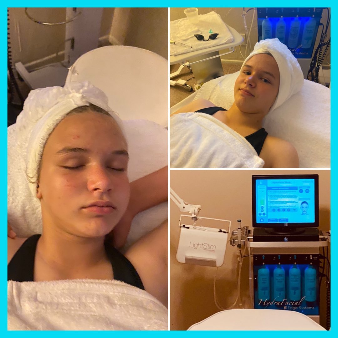 Teen Acne, no problem with Hydra Facial and LightStim therapy 🥰
https://www.facebook.com/beautiful.facials.jennifer/
#acne #teenfacials #BeautifulFacials #Hydrafacial #LightstimTherapy#Loveyourself #brows #tinting #facialwaxing #waxing #beauty
#beautifulbrows
#dermaplane
#Beautifulfacials #hydrafacial #facials #ledlighttherapy