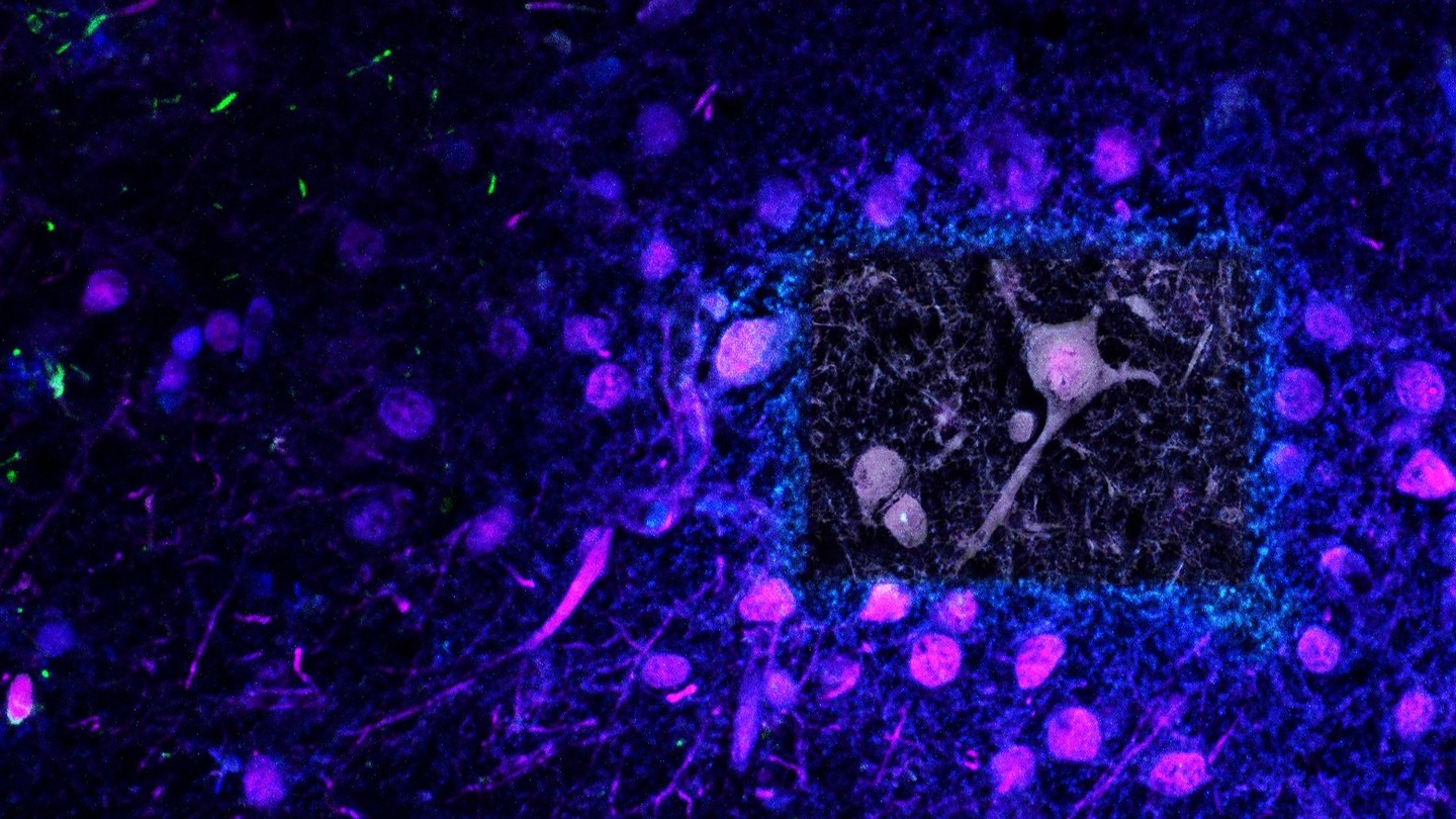 Calcified neuron
#science #electronmicroscope #laboratory #scienceart #sciencephoto #scientific #scienceweek #research #lab #micro #microscope #microscopy #medicine #medicalsciencestudent #medicalstudent #macrophotography #mineralomics #bio #biology #bioimaging #biologylab #minerals #chemistry #material #engineering #physics #sciencecommunication #ucl #DDCSEM #Mineralomics