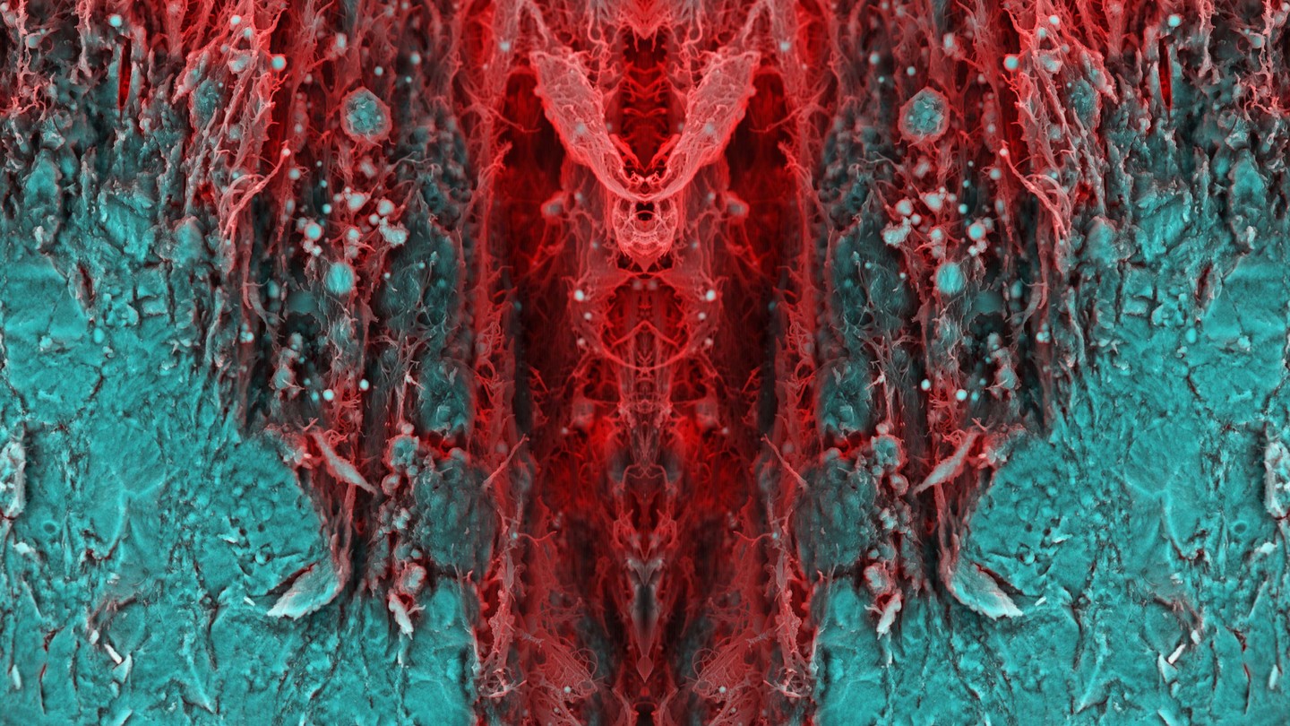 Cardiac calcification
#science #electronmicroscope #laboratory #scienceart #sciencephoto #scientific #scienceweek #research #lab #micro #microscope #microscopy #medicine #medicalsciencestudent #medicalstudent #macrophotography #mineralomics #bio #biology #bioimaging #biologylab #minerals #chemistry #material #engineering #physics #sciencecommunication #ucl #DDCSEM #Mineralomics