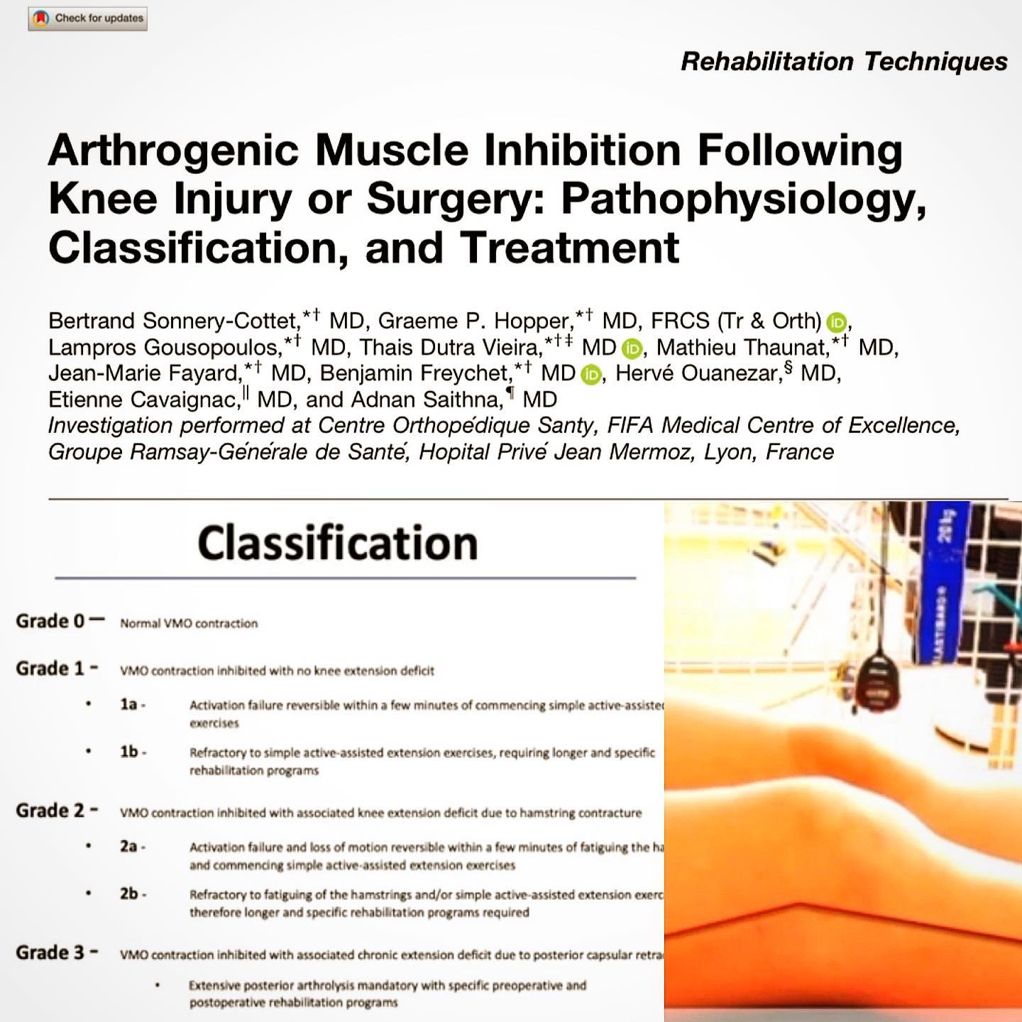 After a Knee injury, not everything should be fixed by the surgery only!
More than a Consultant Knee Surgeon, I am a Knee Specialist first of all.
I can not be more proud than today publishing with our Santi Group this Game Changer paper. It has been definitely changing our daily practice and our vision of knee injury! For me, it’s the perfect example of why we think outside the notch! #santigroup #thinkoutsidethenotch #kneeinjury