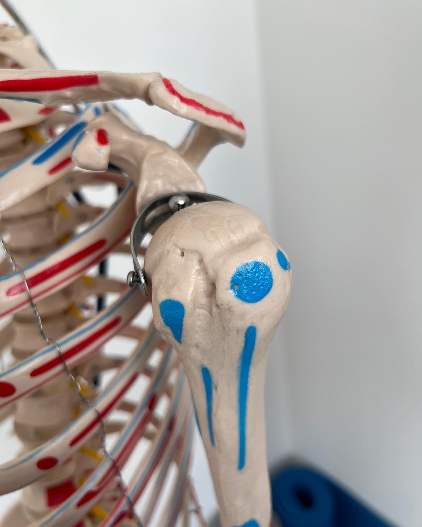 Shoulder press drills! 4 positions
Dumbbell press with band bias
🎯 Challenges shoulder musculature to create stability.
🎯if shoulder niggle, can help as a symptom modifier, so can specifically target an area of improvement.
✅ Go with a lighter dumbbell and band and focus on “form”
✅ Challenges the “cuff”
#shoulderhealth #shoulderprehab #shoulderpain
#Shouldermovement #strength #bandassissted #rehab #physiotherapytreatment #simple