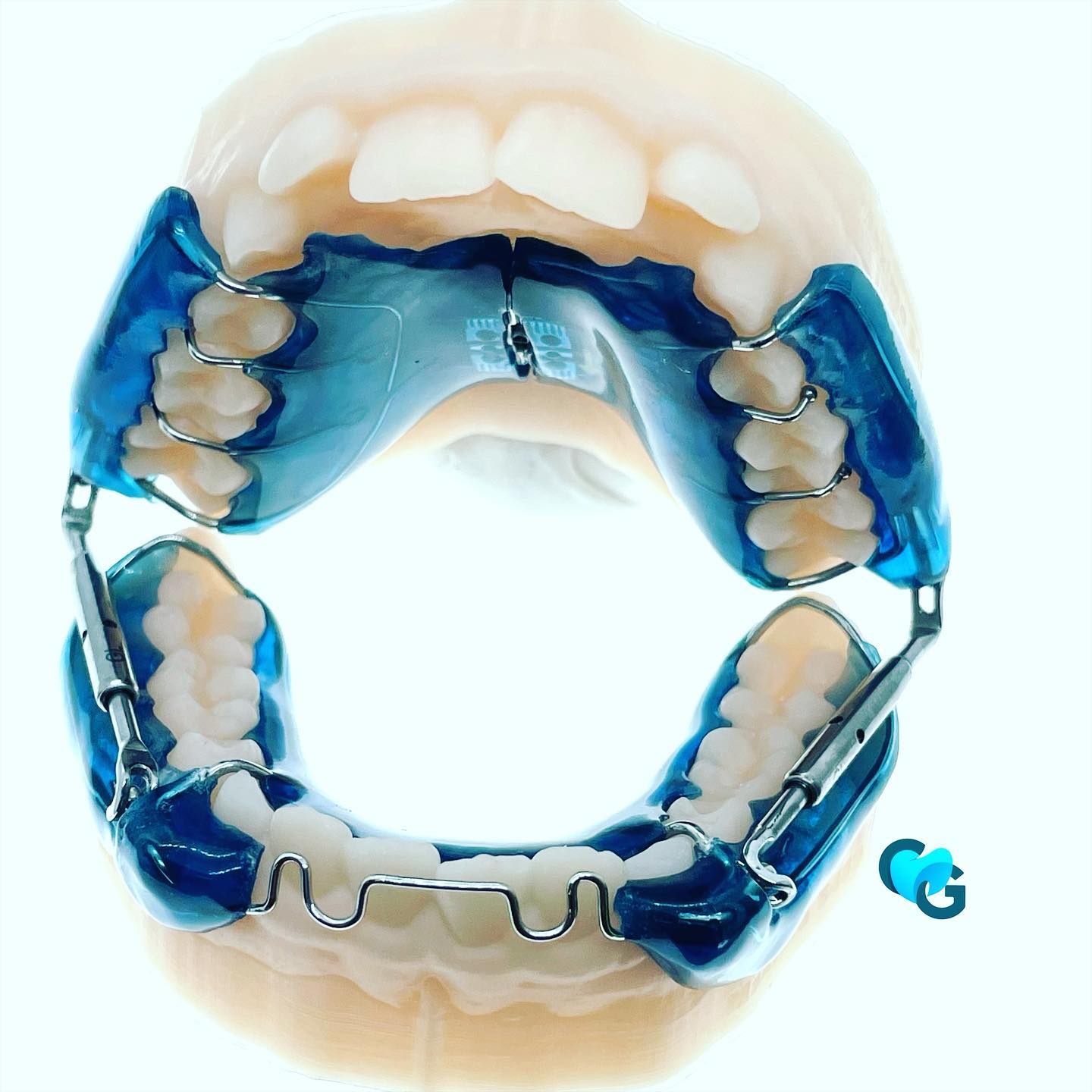Correction en classe 1 Pull concept #pull #pullconcept #arclingual #ortho #orthodontie#labodentaire #techniquedentaire #orthopassion #dentaire #dent #dentition #orthocolors #orthodox #ortho