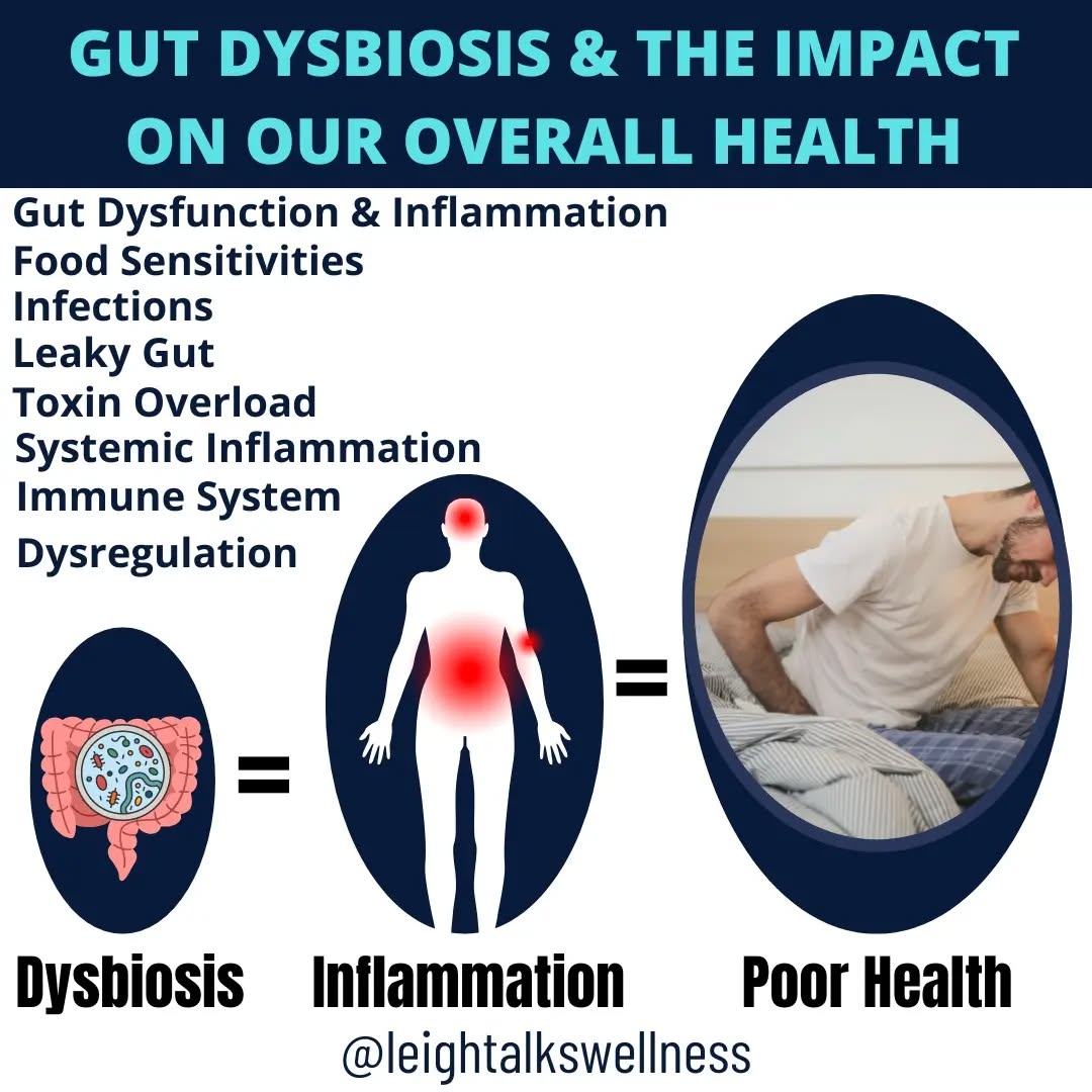 Here's why we need to keep our gut microbiome in check!
👉If our gut becomes dysbiosis (imbalanced), pathogenic organisms can wreak havoc on the digestive system.
Signs and symptoms
▪️Gas / bloating
▪️Constipation / diarrhea
▪️Motility Dysfunction
▪️Reflux / Heart Burn
▪️Brain Fog / Anxiety/ Depression
▪️Food Sensitivities
▪️Bloated after eating
▪️Damaging mucosa & digestive tract
⚠️ Some of these symptoms have become normal in our society, which are NOT!!!!
👉 Left untreated can lead more chronic health problems.
❌️ leaky gut
❌️ toxic overload
❌️ chronic fatigue
❌️ immune system dysfunction
❌️ Auto Immune diseases
Like, Comment or share!
#guthealing #guthealth #guthealthiseverything #guthealthtips #guthealthmatters #dysbiosis #microbiome #detox #Reflux #healthegut #detoxyourbody #toxins #heavymetals #colondrainage #gutmicrobiome #healthchoices #lowtoxliving #healthpractitioner