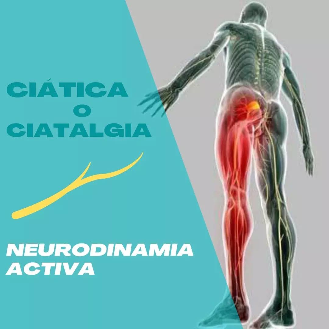🙋♂️Hola a todos! En este post queremos mostraros una técnica que guarda relación con la anterior publicación (sobre la ciática o ciatalgia), por ello os aconsejamos que os paséis previamente a echarle un ojo!
📢Hoy vamos a mostraros un par de ejemplos de como aplicar la Nuerodinamia de forma activa.
❓Pero... ¿De que trata está técnica? Su objetivo es el alivio de los síntomas de origen nervioso (causados por los nervios y el sistema nervioso periférico) que, a través del estímulo mecánico, se provoca una respuesta neurofisiologica de analgesia.
🤸En este caso los ejercicios que os mostramos tienen como finalidad al disminución de los síntomas generados por el nervio ciático a través del deslizamiento del mismo dentro de los tejidos que lo envuelven.
👁️Cuando se realicen estos ejercicios hay que prestar especial atención a la irritabilidad del nervio, para evitar aumentar el dolor, por ello es siempre importante realizar una evaluación previa.
📈Los ejercicios que os mostraros son un ejemplo de progresión respecto a su dificultad, siendo aconsejable realizar aquellos que nos sean sencillos y nos alivien.
👁️¡Esperamos que os gusten! Para cualquier pregunta no dudéis en contactar con nosotros.
¡Feliz semana a todos!