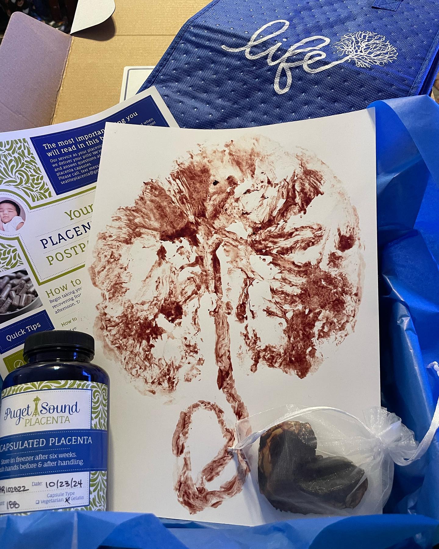 Wow, what a beautiful print! I love sending these little packages out!
Our streamlined process makes getting started as easy as 1, 2, 3!
Visit www.seattleplacenta.com to booK your service NOW! Return shipping included in all services
#thejourneybegins #thisisbirth #hospitalbirth #seattlebirth #seattlebirthworkers #placenta #placentamagic
#placentaencapsulation #placentapills #seattleplacenta #pugetsoundplacenta
#postpartumhealth #postpartumanxiety