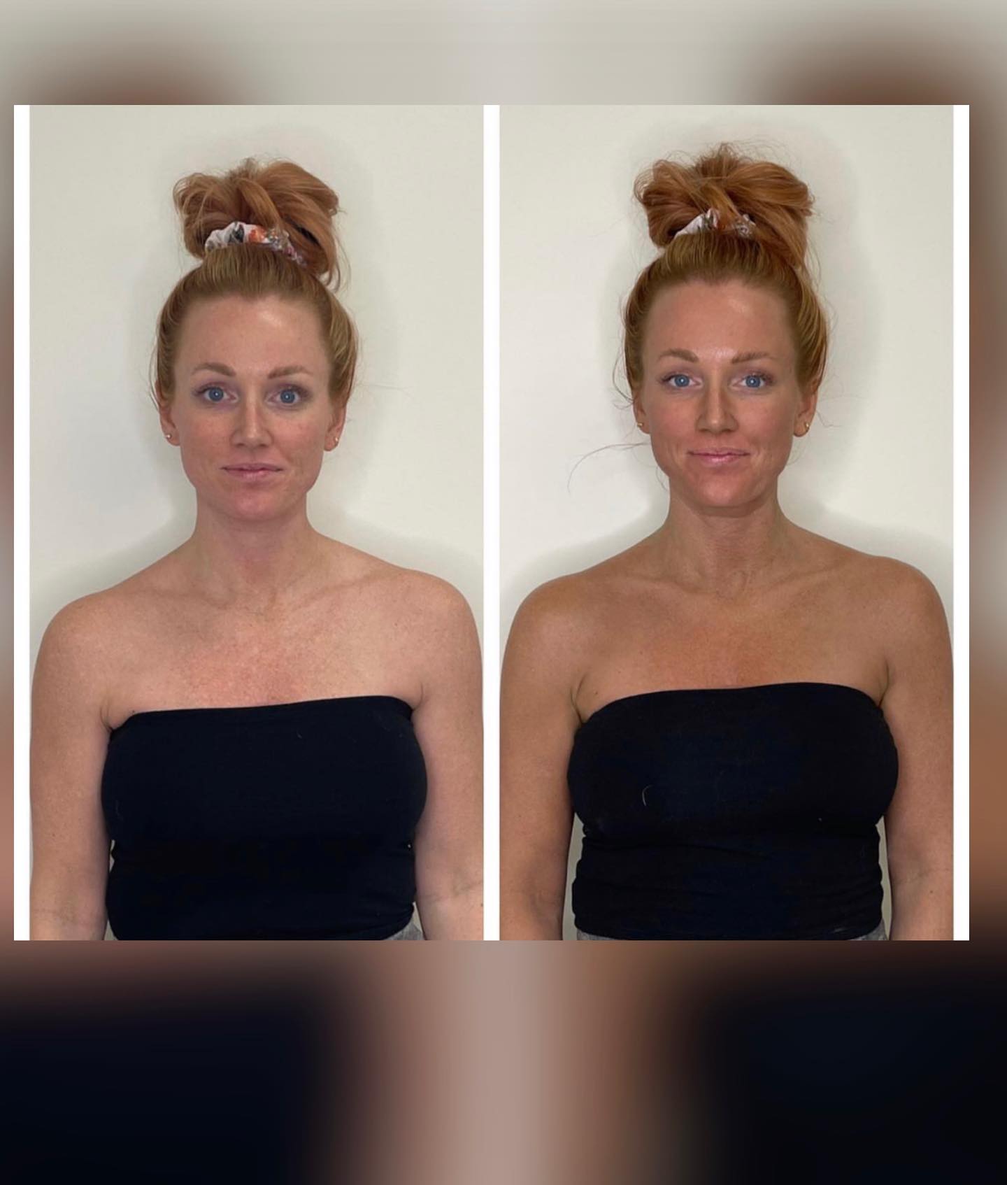 SPRAY TAN , PRE AND POST TIPS. ✅ Exfoliate and shave BEFORE you come in for your spray tan !
✅ It is ideal to come in with clean , exfoliated bare skin No lotion , make up deodorant These can act as barrier not allowing the spray solution to colour your skin. ✅Underarm discolouration can occur when the spray tan solution reacts to the deodorant you are wearing; The good news is temporary and will disappear when you rinse ! ✅To keep your spray tan lasting as long as possible keep yourself and your skin hydrated! Apply lotion, sunscreen , and drink water ! ##. ##spraytan##spraytanlondon##mortlake##barnes##putney##eastsheenvillage##eastsheenmums##dearbeauty##sunbed##tann##tanning##tanningsalon##richmondtan##beautysalon##beautysaloneastsheen##beautysalonrichmond##beautysalonmortlake##goldenbrown##goldentan##tanningsalon##tanningsalonoftheyear##tanningsalonlife