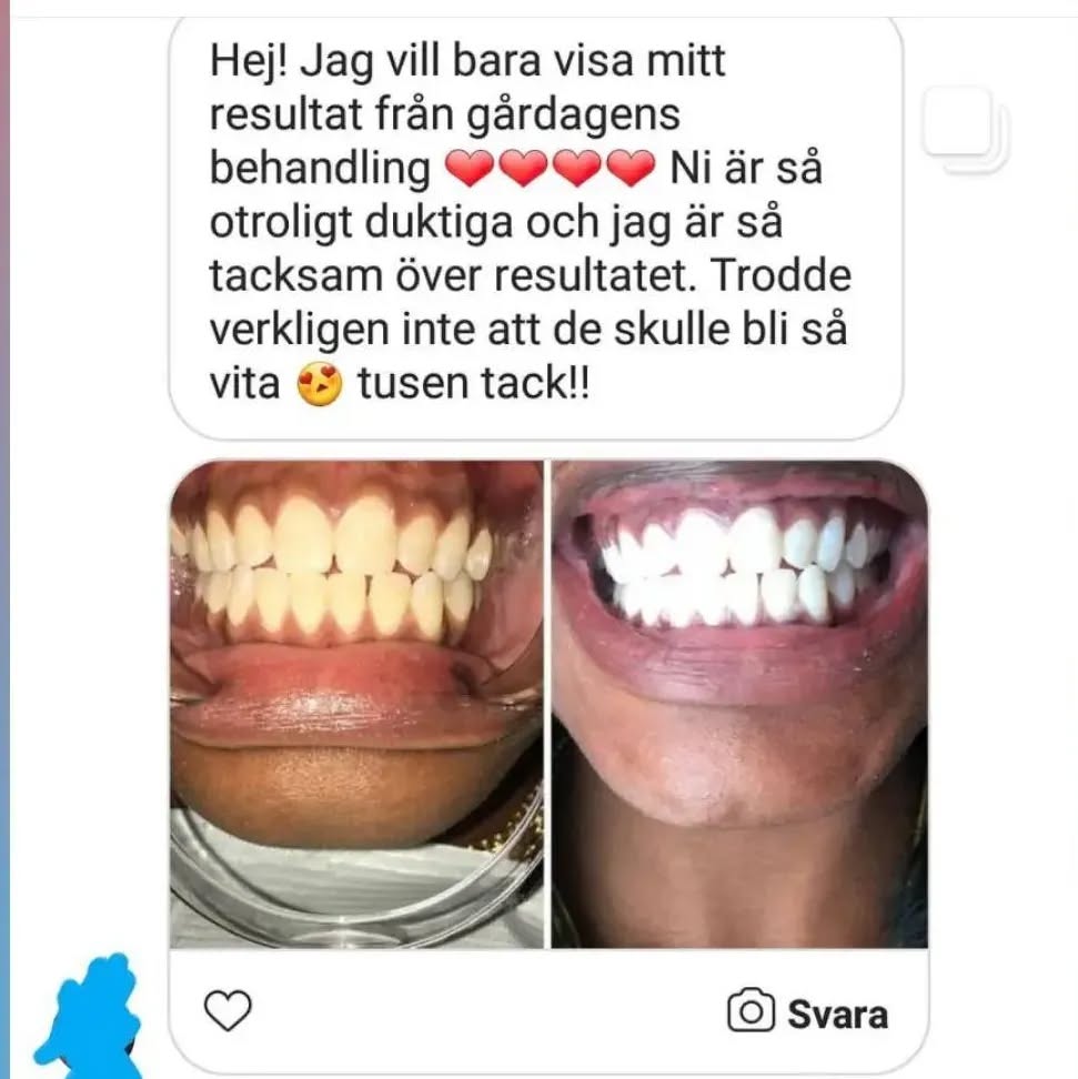 Tusen tack för den fina responsen som vi får ❤️
 #tandblekningstockholm #TandblekningStockholm #stockholm #liljeholmen #KlinikTandblekning #TandblekningGöteborg #TandblekningUppsala #TandblekningUtbildning #fillers #fillersstockholm #fillersgöteborg #fillersmalmö #TandblekningsUtbildning