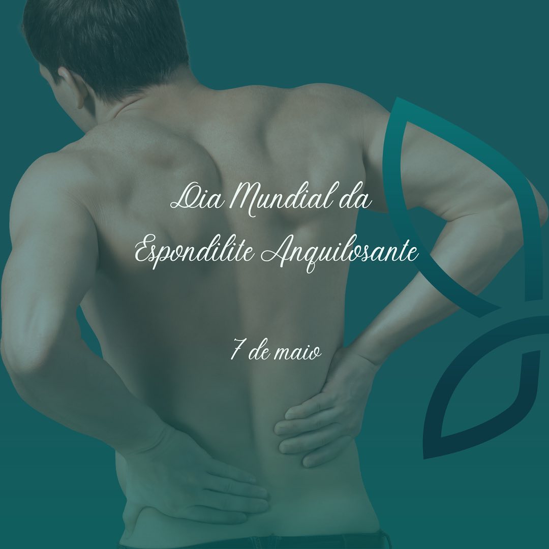 ❓Você sabe o que é Espondilite Anquilosante❓
➡️ A espondilite anquilosante é uma doença inflamatória, autoimune, que acomete principalmente o esqueleto axial (coluna e bacia), mas pode afetar também outras articulações, como joelhos, tornozelos e mãos.
🤷🏻♂️ É mais prevalente em homens e, normalmente, inicia em idade jovem, abaixo de 40 anos. Porém, por ser uma doença pouco conhecida, o diagnóstico muitas vezes é demorado e acaba sendo em idade mais avançada.
🚨 Sua principal manifestação é dor em região lombar, que piora com o repouso, associada a rigidez ao acordar.
😉 Você tem ou conhece alguém que tem espondilite? Quer saber mais sobre a doença? Escreva aqui nos comentários! ⤵️