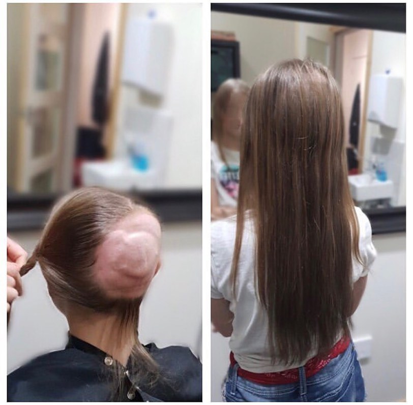 Hair Course Availability
Hair Replacement Course - Monday 19th June - Monday 10th July
The Hair Lab has provided Hair Replacements & Trichology Services to clients suffering from hair loss for over 6 years now. You too can provide this service by completing our course. We are fully accredited and insured to teach you this life changing service. It is a great solution for men and women suffering from hair loss.
In this course we will cover;
Health & Safety
Contraindications
Anatomy & Physiology
Hair Loss Conditions
Application, Maintenance & Removal
Aftercare & Pricing
Different Bases & Hair
You will receive a course manual and a certificate upon completion.
Message us directly to get booked on this course. .
.
.
.
.
#lacetopwigs #lacefrontwigs #lacewigs #wigs #lacefrontal #alopecia #areata #hairloss #hairreplacements #bespokewigs #customcolouredwigs #handmadewigs #wigbuilding #hairintegration #laceintegration #hairextensions #weave #hairlossspecialist #trichologist #trichology #hairlosssolution #hairlosssalon #hair #hairdresser #barber