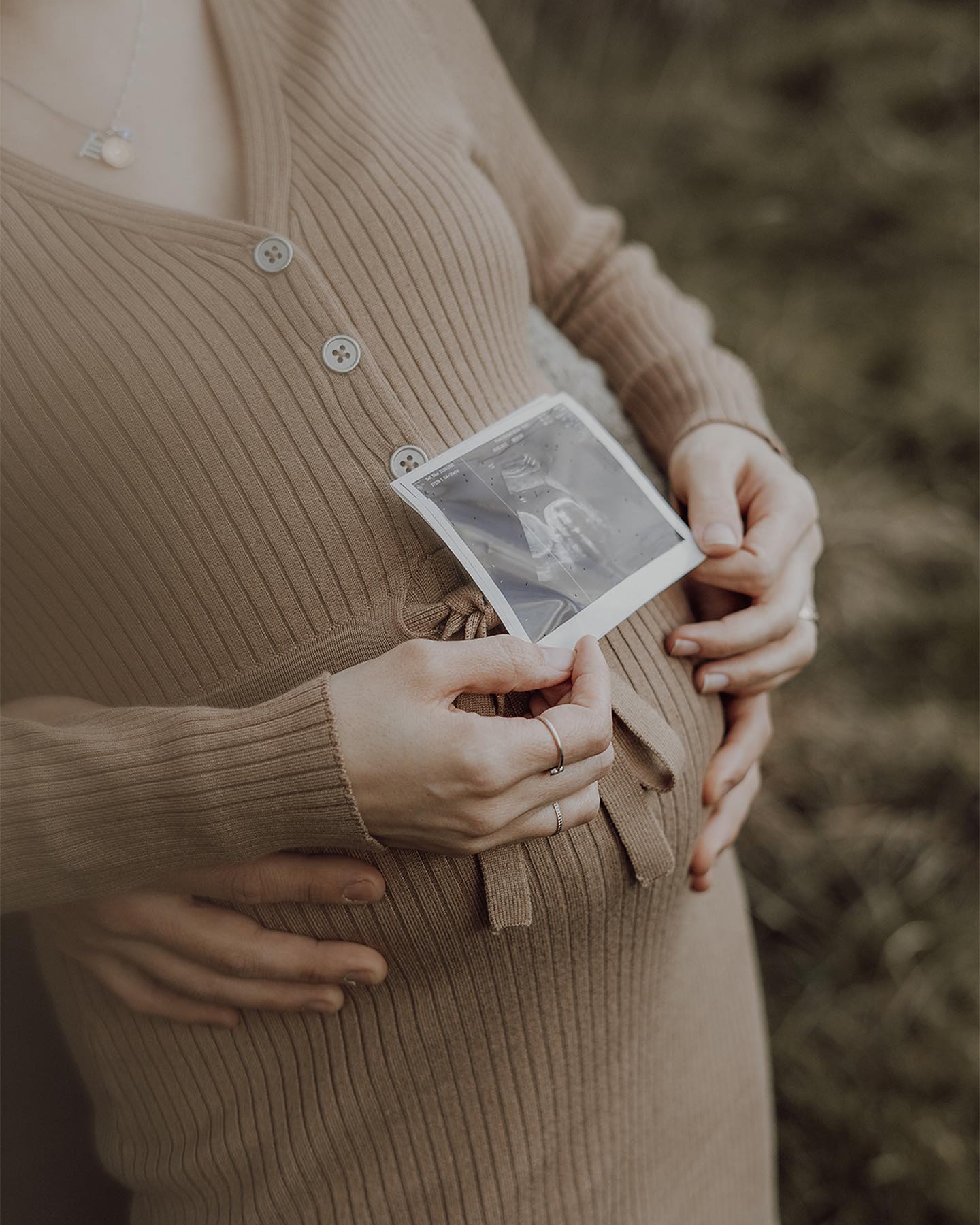Wenn aus Liebe Leben wird 🥰🤰🏼
#babybauchshooting #pregnancyshoot #pregnancy #schwangerschaftsshooting #babybauchfotos #maternityphotoshoot #babybelly