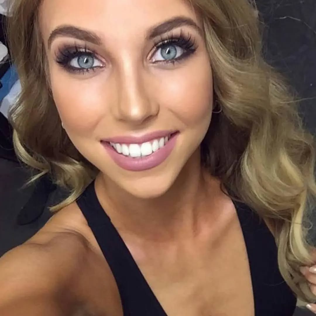 ERBJUDANDE 995 KR När ni bokar för 2 personer (DUO BEHANDLING)(Ordinarie pris 4900 kr) 
ONLINE TIDSBOKNING
www.DentalClinicSweden.org🔺️
 #tandblekningstockholm #TandblekningStockholm #stockholm #liljeholmen #KlinikTandblekning #TandblekningGöteborg #TandblekningUppsala #TandblekningUtbildning #fillers #fillersstockholm #fillersgöteborg #fillersmalmö #TandblekningsUtbildning