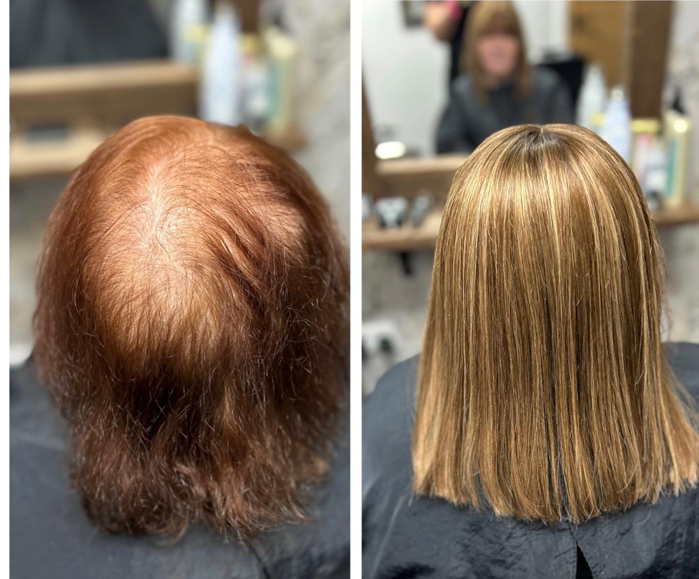 It was very emotional for this lady today seeing her system all fitted. She is over the moon with it. .
.
.
.
.
.
.
#lacetopwigs #lacefrontwigs #lacewigs #wigs #lacefrontal #alopecia #areata #hairloss #hairreplacements #bespokewigs #customcolouredwigs #handmadewigs #wigbuilding #hairintegration #laceintegration #hairextensions #weave #hairlossspecialist #trichologist #trichology #hairlosssolution #hairlosssalon #hair