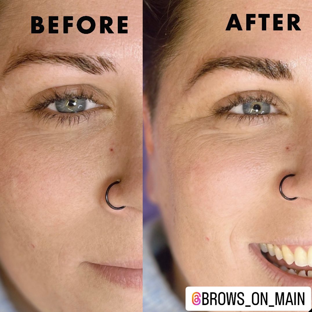 Have I told you lately that I love that I do?! Who wouldn’t?!
No more waking up to pencil in the missing pieces every day! Look at that smile- it says it all!! 👌
.
.
.
.
.
.
.
.
.
#cosmeticbrows #cosmeticbrowtattoo #cosmeticbrowspecialist #cosmeticeyebrows #microbladebrows #microbladedbrows #microbladed #microbladedeyebrows #cosmetictattooing #cosmetictattooartist #cosmetictattoobrows #eyebrowsmicroblading #microbladingbrows