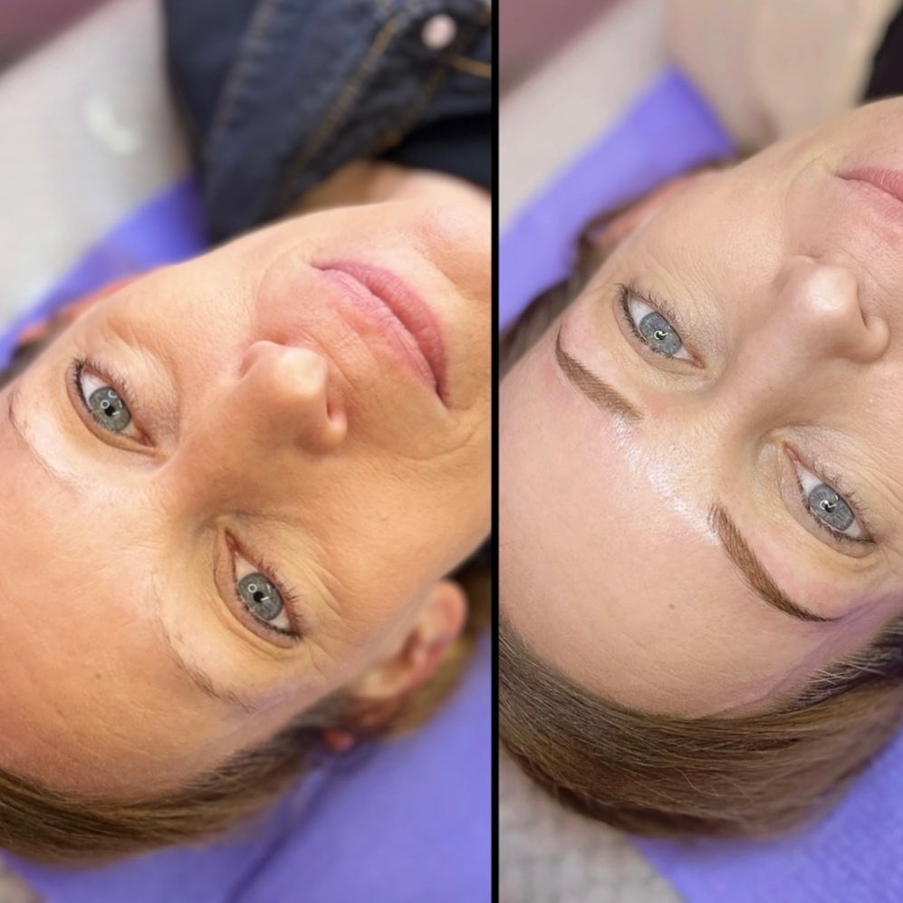 - T R A N S F O R M A T I O N -
This client will tell you how excited I was when she walked through my doors! I’d mapped this result in my head before she even had a chance to sit down 👌
Time to take your brows to the next level!! What do you think of this result? Comment below…
.
.
.
.
.
.
.
.
.
.
.
#combinationbrows #combinationbrow #combinationbrowtattoo #combinationeyebrows #combinationeyebrowtattoo #powderbrow #powderbrowstattoo #powderbrowsartist #powdereyebrows #powdereyebrowtattoo #melbournebrowtattoo
