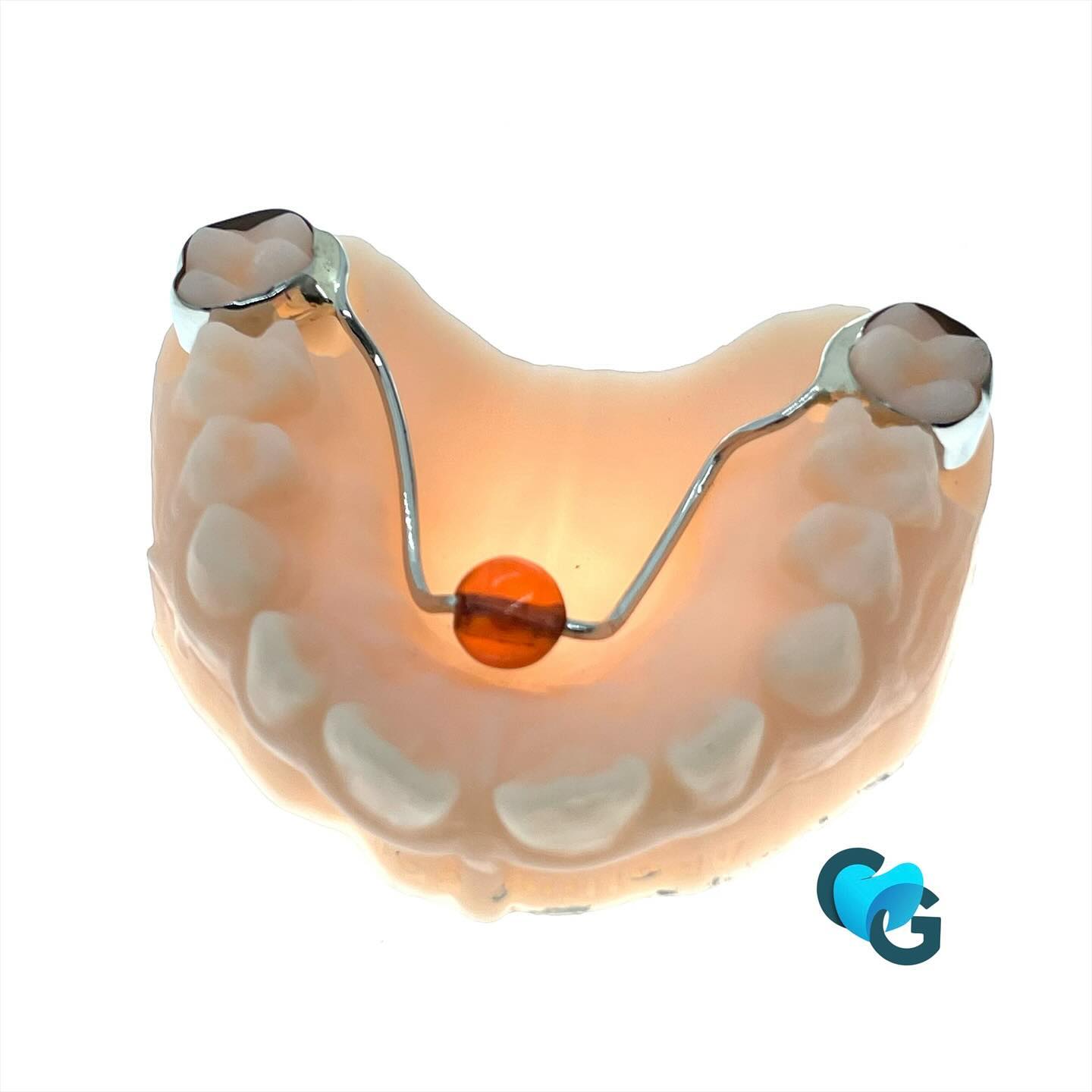 #perledetucat #laboratoiredentaire #ortho #orthodontie #orthodontist #dental #dent #bouche #tucat #tucatpearl #béance #dentaire