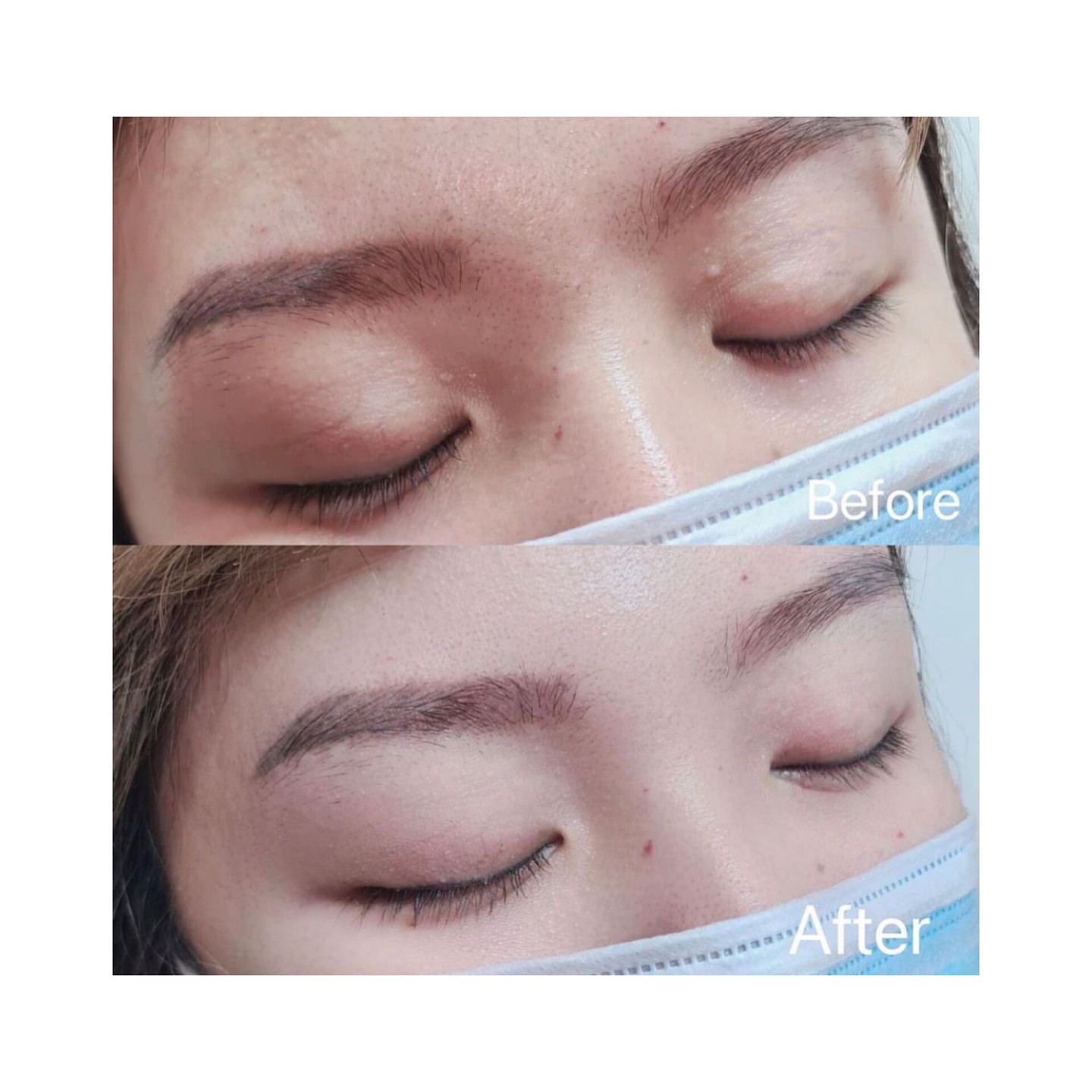 Annoyed by those stubborn white spots that wont go away no matter whatever you do ? come visit us and get them permanently removed instantly.😍 #dearbeauty #dearbeautylondon #eastsheen #eastsheen #richmond #barnes #eastsheenvillange #eastsheenprimaryschool #eastsheenmums #putney #putneymums #beautysaloneastsheen #richmondbeautysalon #mortlake #mortlaketoputney #beautybarnes #milia #miliaremoval #miliaremovaltreatment