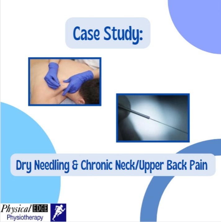 Experiencing chronic neck/ upper back pain? Check out this post on how the physiotherapy team at Physical Edge can help!
•••
Case study by Arthur Pamplona Nolasco, Registered Physiotherapist
#physiotherapy #chronicneckandbackpain #dryneedlingtherapy #painreleif