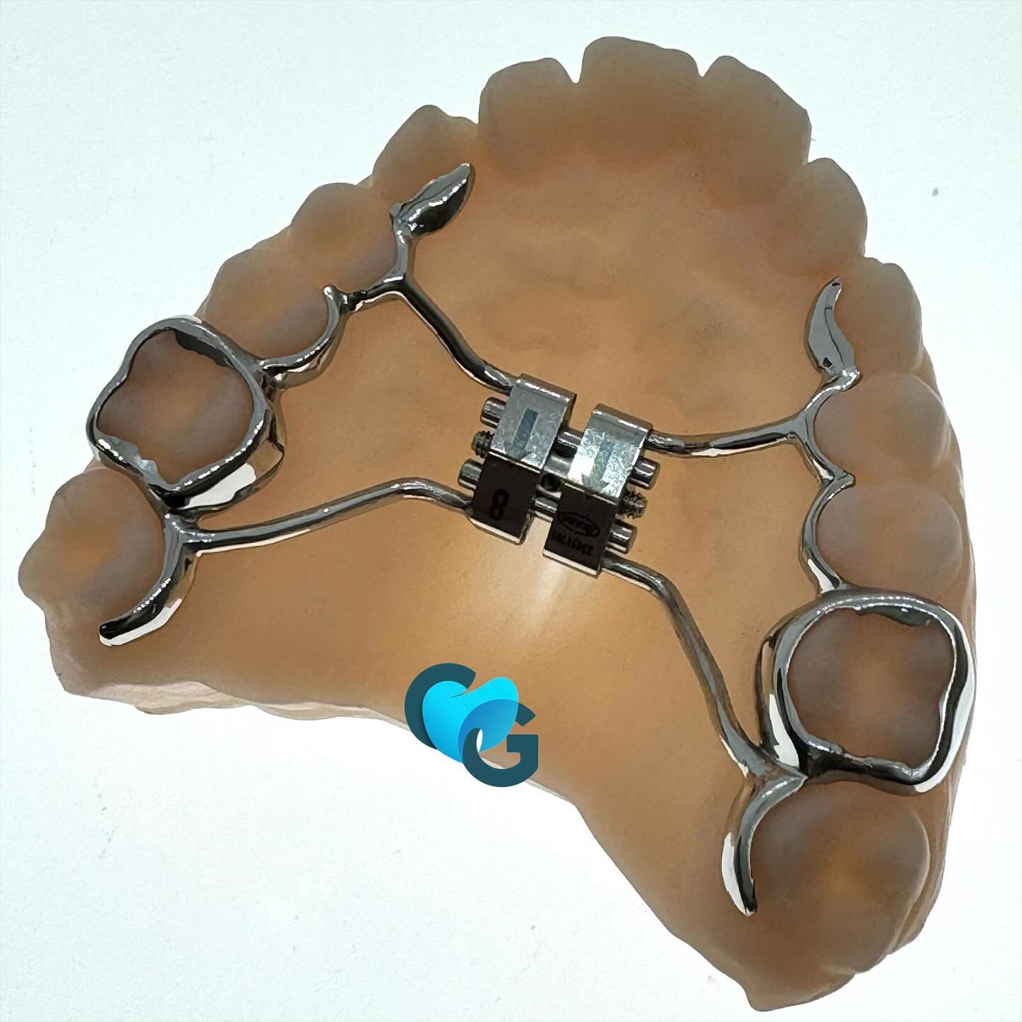 #frittage #frittagelaser #impressionmetallique #disjoncteur #hyrax #ortho #orthodontie #dentalart #dental #expansionforcee #appareilfixe #baguesanatomiques #3dprinting #leone