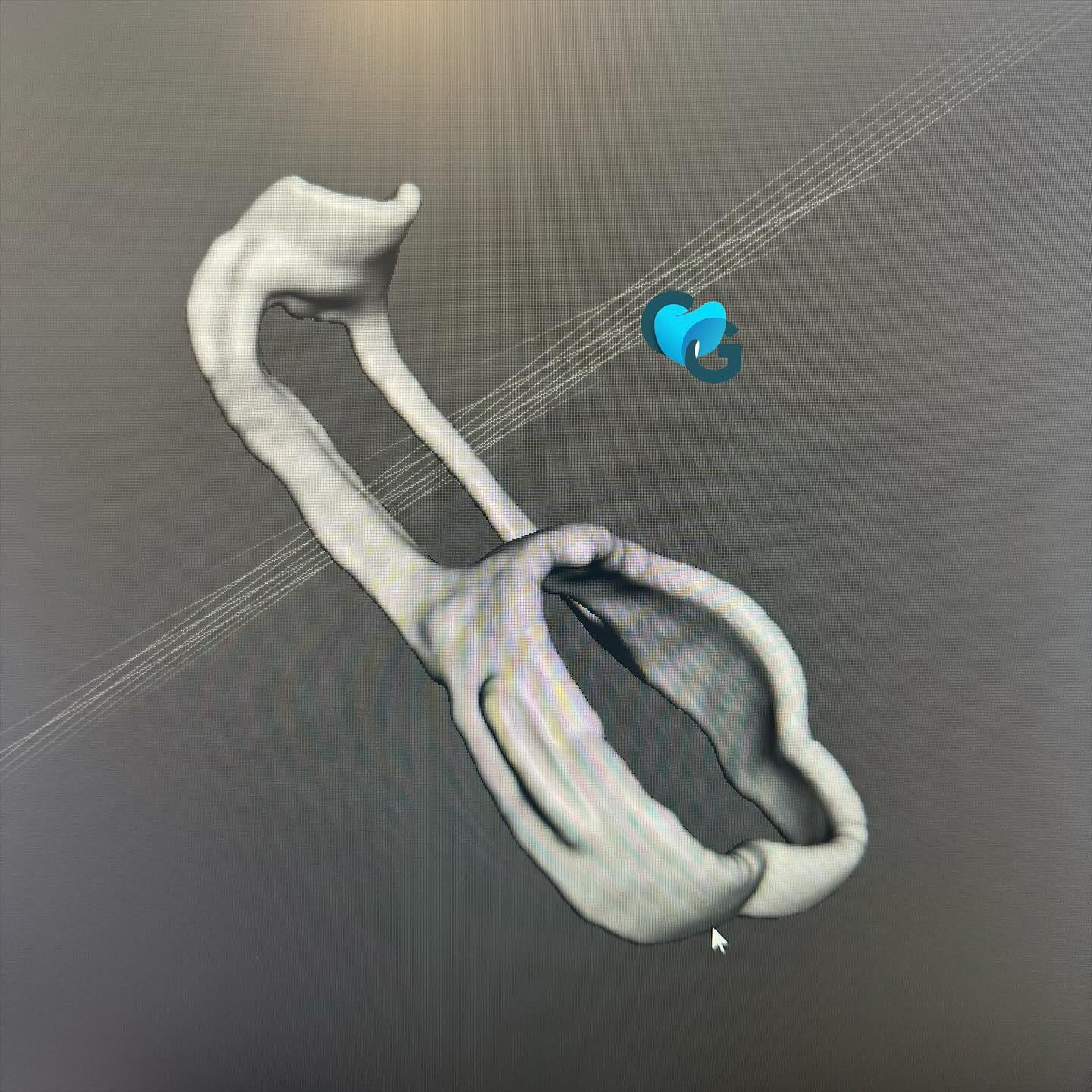 Garde place numérique #garde place #ortho #orthonumérique #bagues #frittagelaser #frittagedepoudre #dentaire