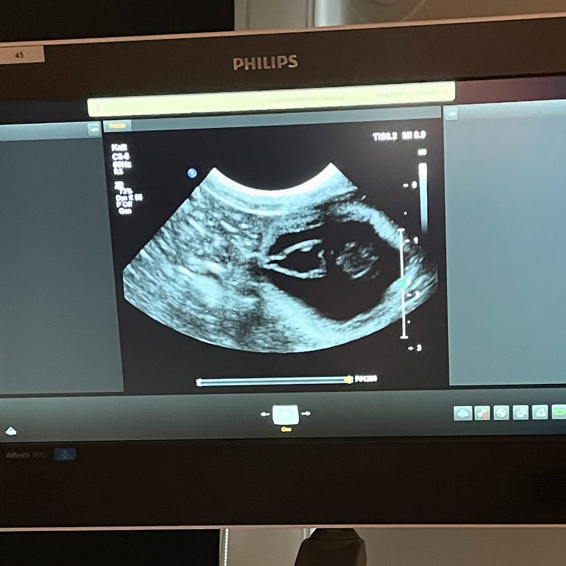 Babykittens on it’s way 🎉 Summerbabies 🎉 #sacredbirman #birman #birmancat #fluffy #longhair #helligbirma #lilacpoint #sealpoint #colourpoint #colorpoint #whitecoat #blueeyes #blueeyedcat #birma #catsoninstagram #catsofinstagram #cats #cat #catsoftheworld #catsagram #catoftheday #kattensrollsroys #bellatrixlestrange #luciusmalfoy