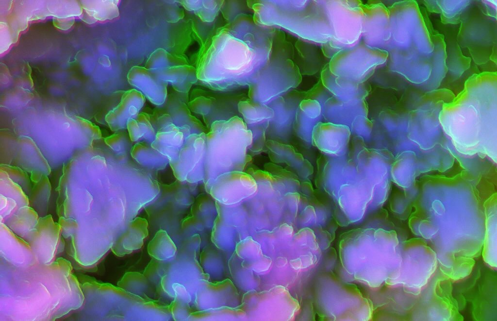 Kidney stones
#science #electronmicroscope #laboratory #scienceart #sciencephoto #scientific #scienceweek #research #lab #micro #microscope #microscopy #medicine #medicalsciencestudent #medicalstudent #macrophotography #mineralomics #bio #biology #bioimaging #biologylab #minerals #chemistry #material #engineering #physics #sciencecommunication #ucl #DDCSEM #Mineralomics