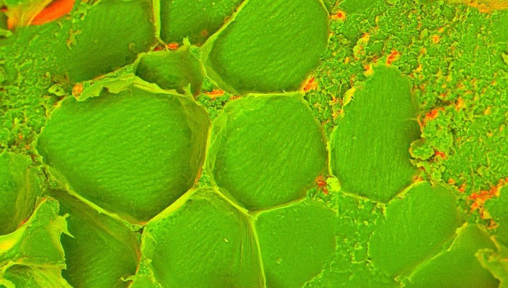 Muscle calcification
#science #electronmicroscope #laboratory #scienceart #sciencephoto #scientific #scienceweek #research #lab #micro #microscope #microscopy #medicine #medicalsciencestudent #medicalstudent #macrophotography #mineralomics #bio #biology #bioimaging #biologylab #minerals #chemistry #material #engineering #physics #sciencecommunication #ucl #DDCSEM #Mineralomics