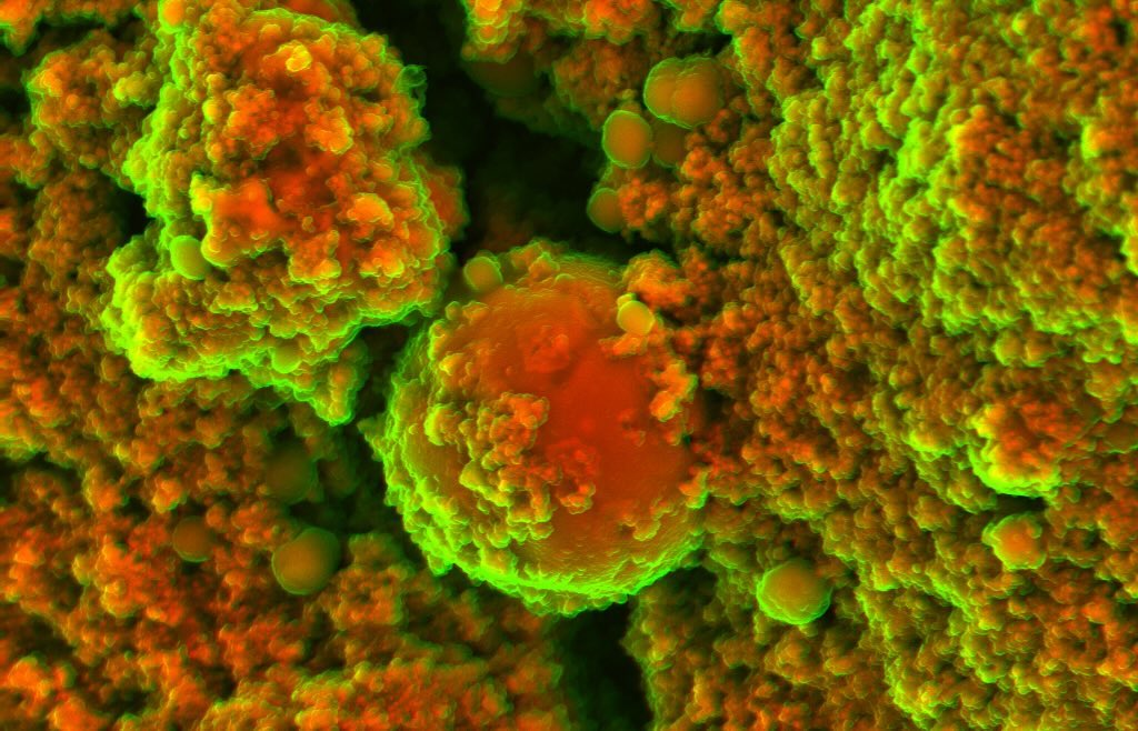 Cardiac calcification
#science #electronmicroscope #laboratory #scienceart #sciencephoto #scientific #scienceweek #research #lab #micro #microscope #microscopy #medicine #medicalsciencestudent #medicalstudent #macrophotography #mineralomics #bio #biology #bioimaging #biologylab #minerals #chemistry #material #engineering #physics #sciencecommunication #ucl #DDCSEM #Mineralomics